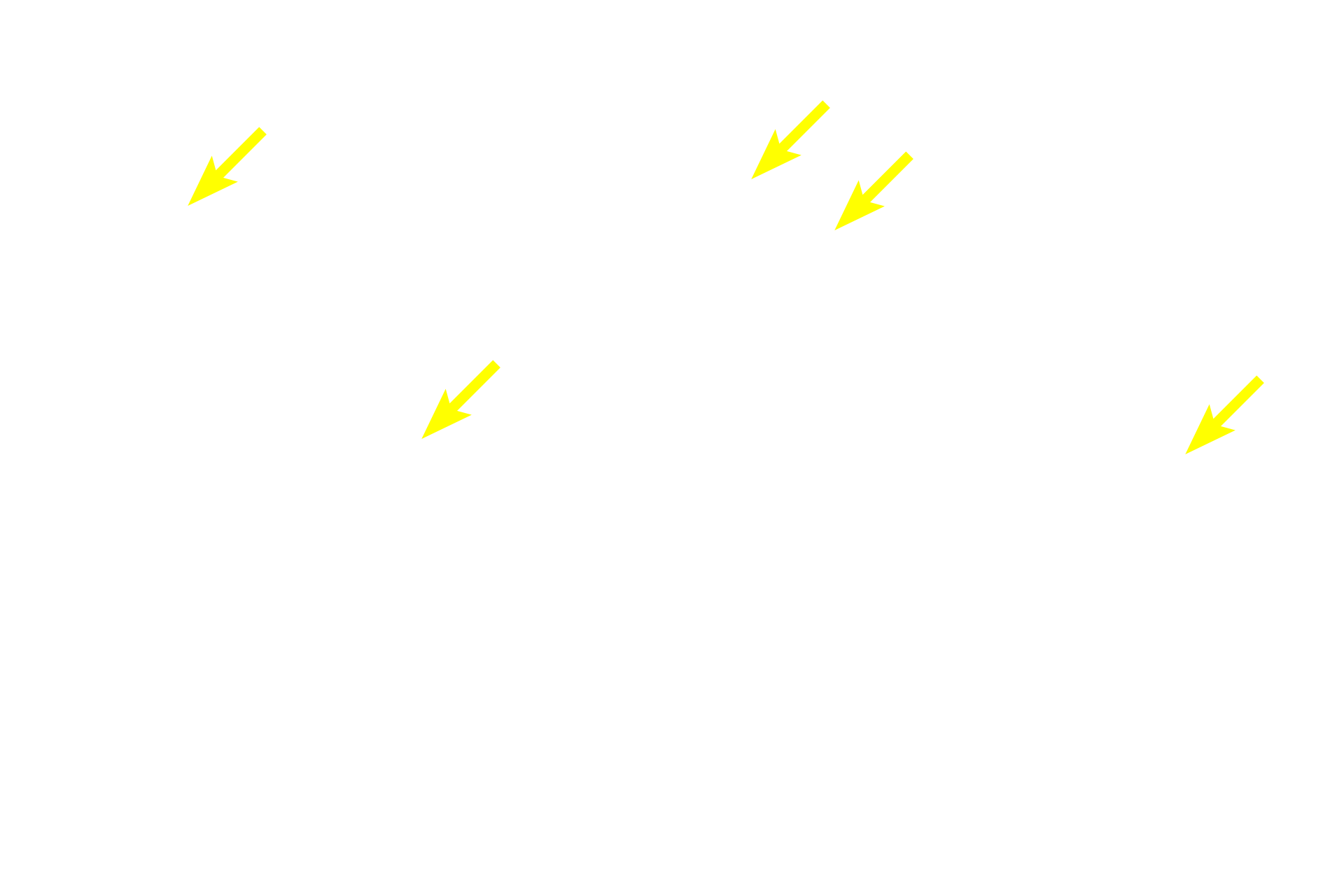Muscle fibers <p>A skeletal muscle is an organ, composed mostly of skeletal muscle fibers that are surrounded by three connective tissue layers: endomysium, perimysium and epimysium. These layers (1) bind the muscle fibers together; (2) separate groups of fibers into compartments; and (3) transmit the force of contraction to the point of muscle insertion. The three layers and are clearly shown in this section stained for connective tissue. Masson stain 100x</p>

