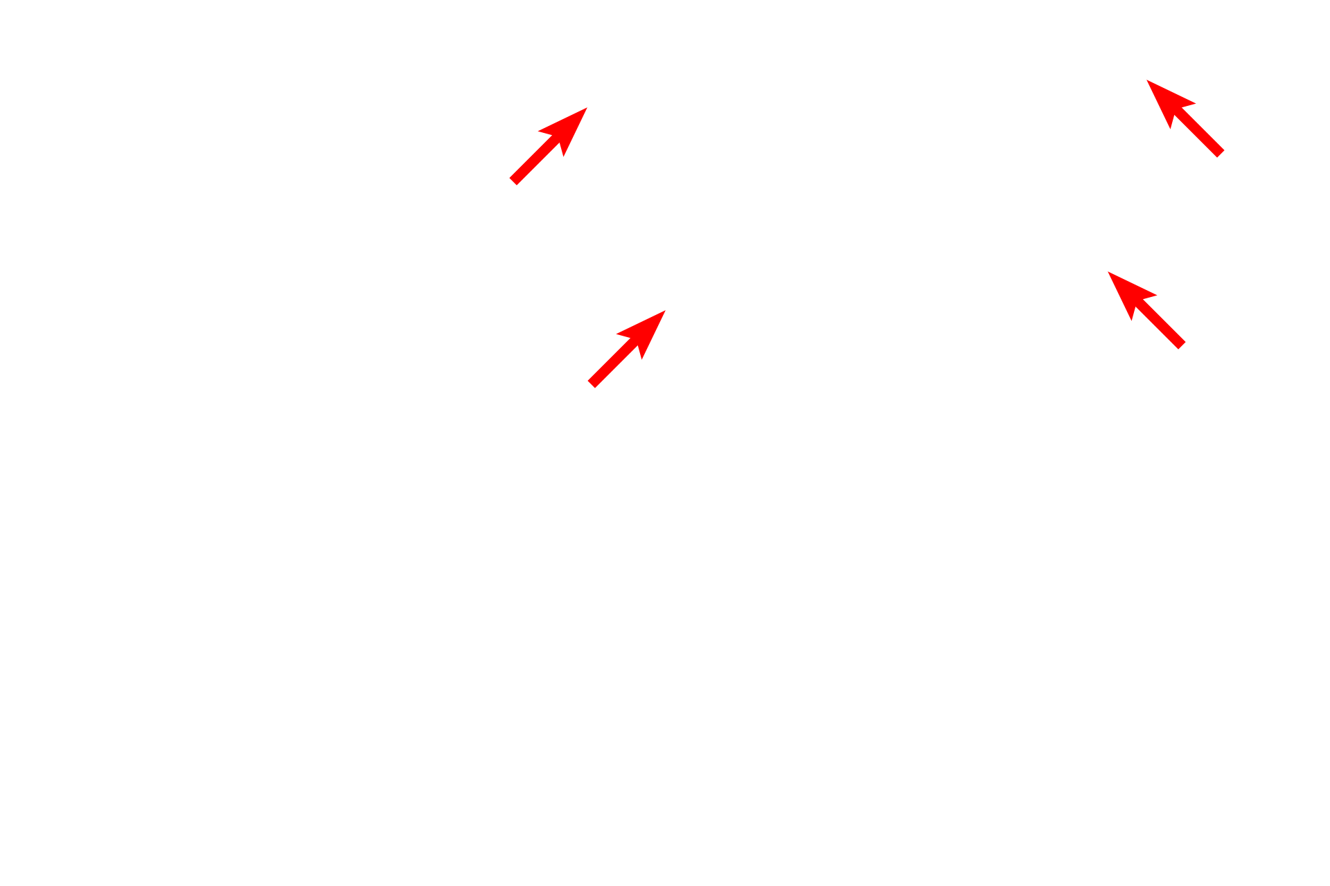 Perimysium > <p>The perimysium encloses groups of fibers, defining fascicles.</p>

