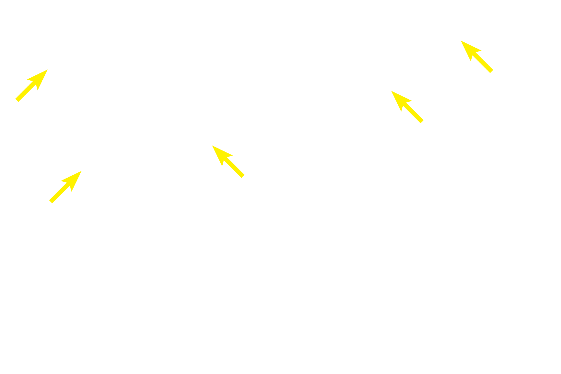 Endomysium > <p>The endomysium surrounds individual muscle fibers.</p>
