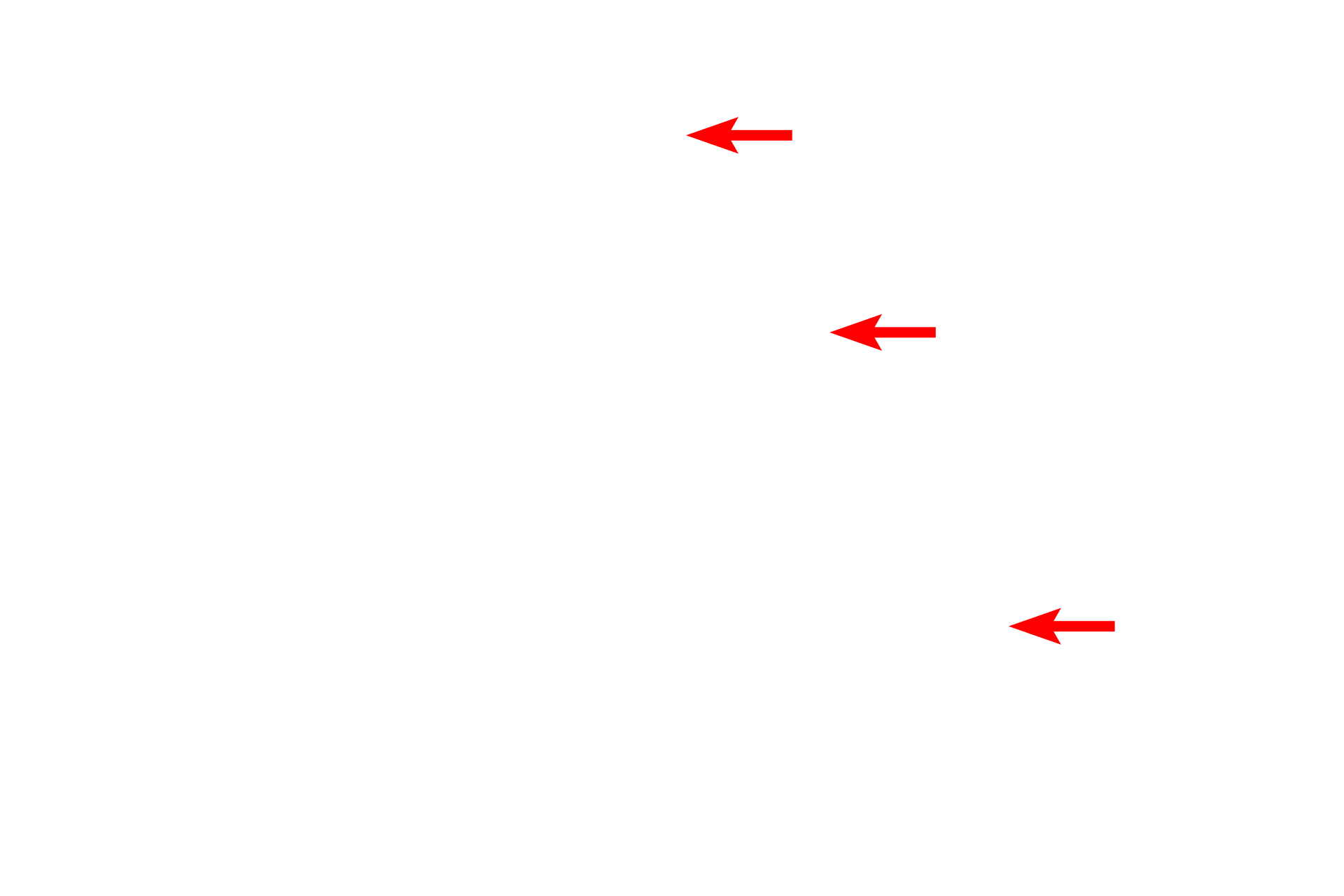  - Reticular fibers <p>Skeletal muscle fibers secrete an external lamina that lies immediately adjacent to the sarcolemma (cell membrane). Outside the basal lamina is a layer of reticular fibers, produced by fibroblasts, which form the endomysium. Some consider the basal lamina to be a component of the endomysium. 15,000x</p>
