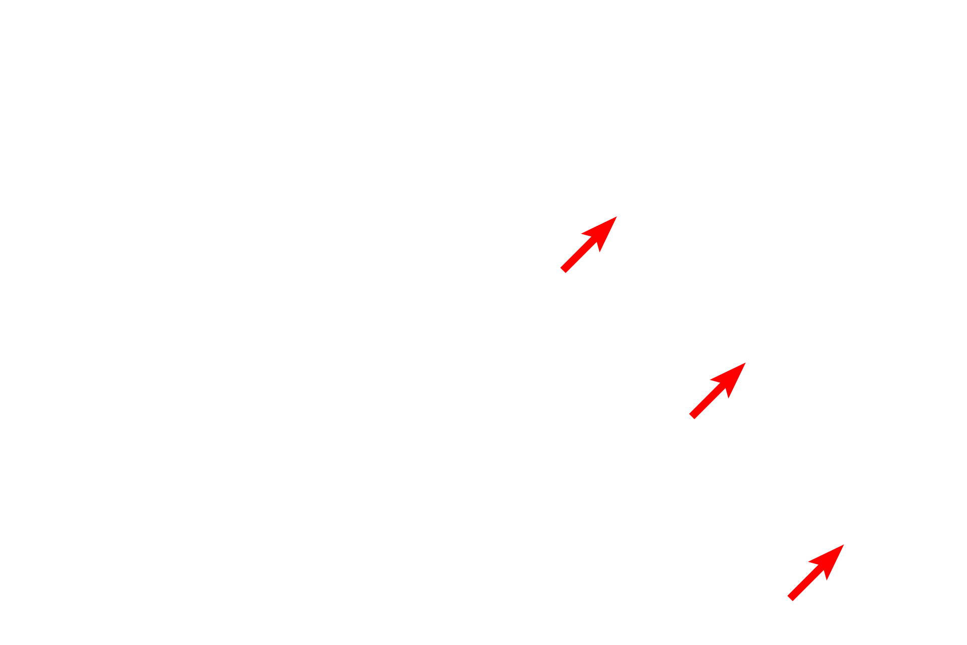  - Fibroblast process <p>Skeletal muscle fibers secrete an external lamina that lies immediately adjacent to the sarcolemma (cell membrane). Outside the basal lamina is a layer of reticular fibers, produced by fibroblasts, which form the endomysium. Some consider the basal lamina to be a component of the endomysium. 15,000x</p>

