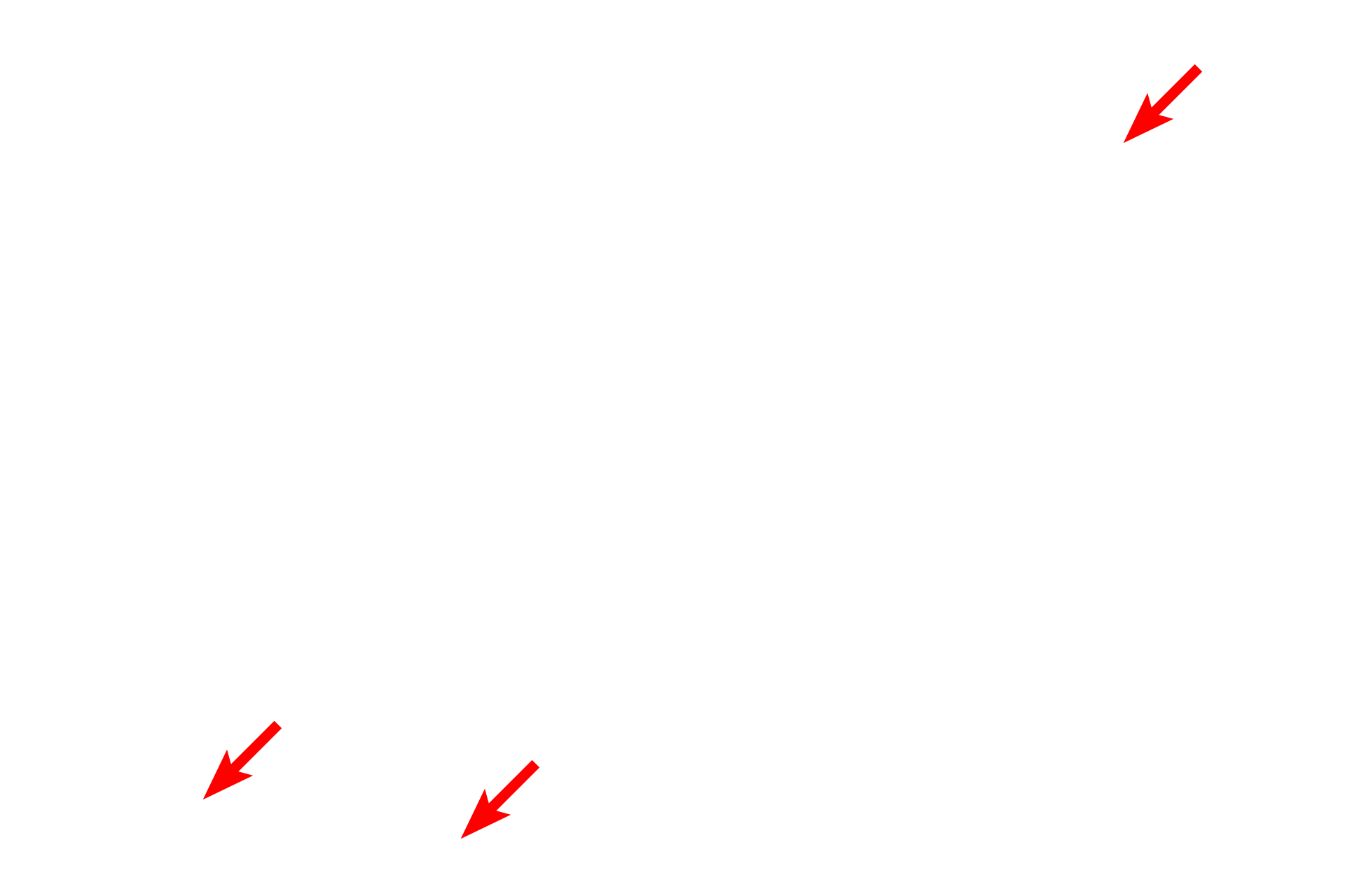  - Myofilaments <p>Skeletal muscle fibers secrete an external lamina that lies immediately adjacent to the sarcolemma (cell membrane). Outside the basal lamina is a layer of reticular fibers, produced by fibroblasts, which form the endomysium. Some consider the basal lamina to be a component of the endomysium. 15,000x</p>
