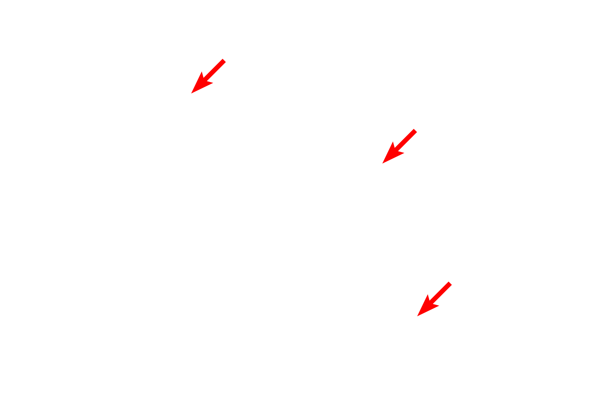 Nerve cells <p>This combination stain is also called the Kluver-Barrera method and is commonly used to stain nervous tissue. The stain consists of cresyl violet, which stains basophilic structures similarly to hematoxylin, and luxol fast blue, which stains the myelin sheath turquoise. Brainstem 400x</p>
