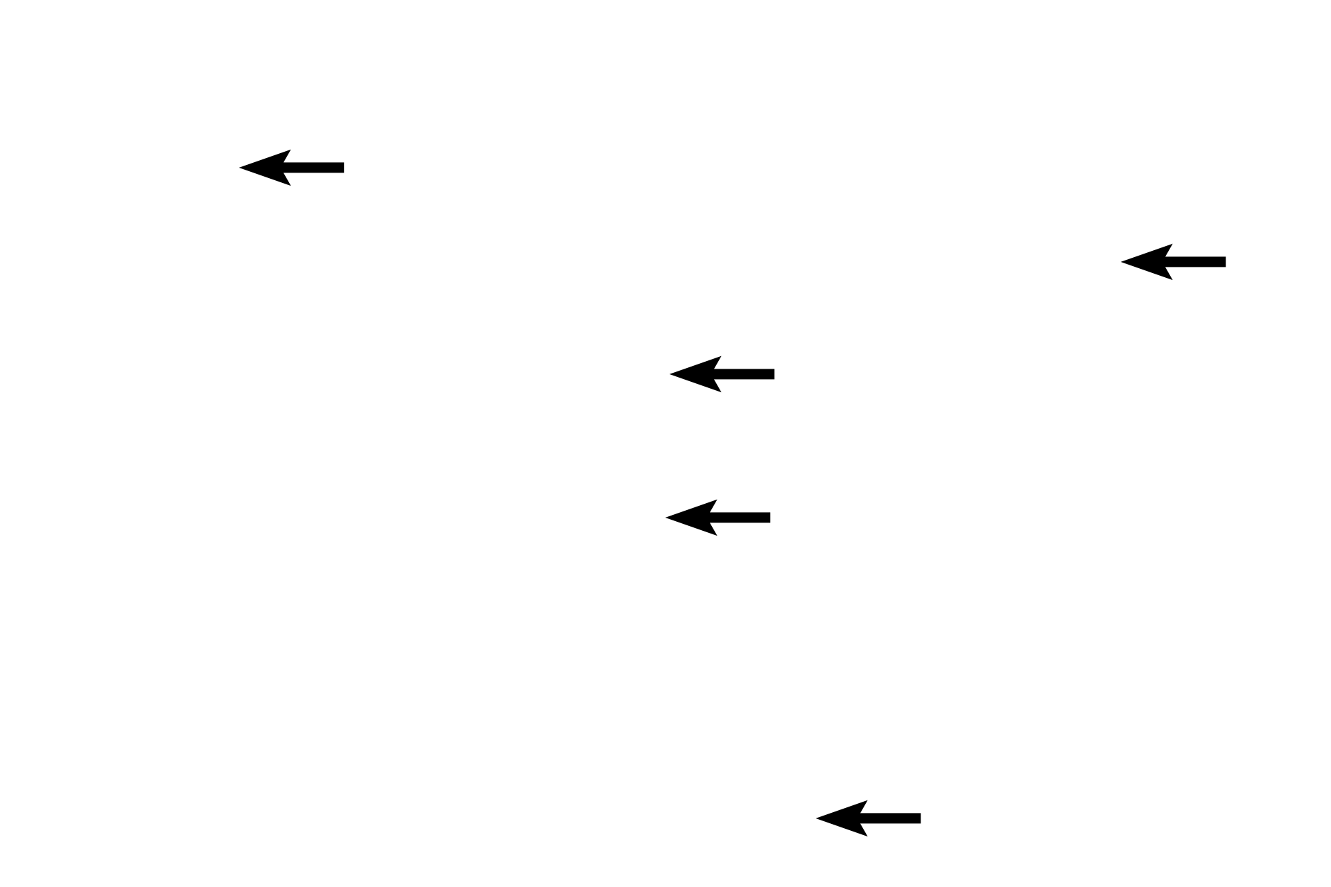 Secretory granules > <p>The secretory product manufactured by the RER is packaged into secretory granules. These granules accumulate in the apex of each cell, adjacent to the lumen into which they will be released. Secretory granules stain pink with eosin and impart a grainy appearance to the apex of these cells.</p>
