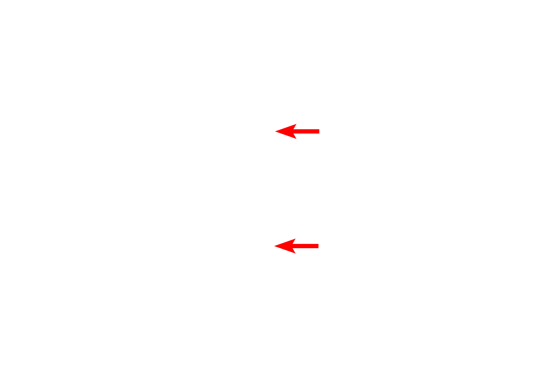  - Gland cell nuclei <p>For these glandular cells, the secretory granules are homogeneously distributed in the cytoplasm and hence these cells lack polarity.  The hormone that these cells secrete can be released from any site on the cell surface.   Pituitary gland 1000x.</p>
