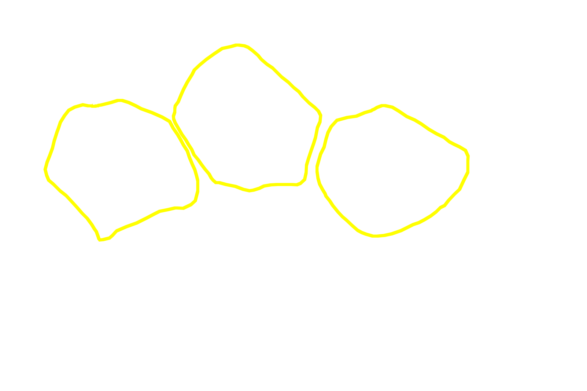Muscle fibers > <p>Muscle fibers appear as irregular polygons and their cytoplasm is filled with myofibrils. Their nuclei are not visible in this image.</p>
