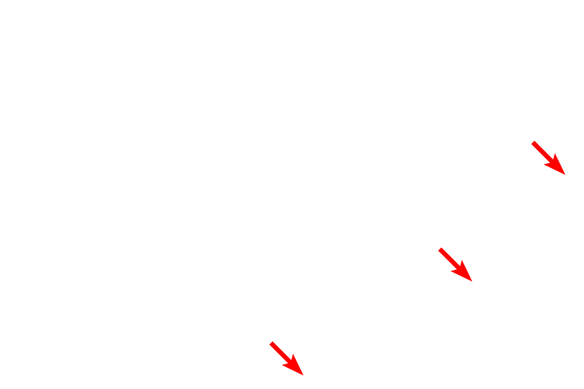 Perimysium > <p>The perimysium, composed of Type I collagen fibers, encloses groups of skeletal muscle fibers, forming functional groups called fascicles. Larger blood vessels and nerves travel in the perimysium.</p>
