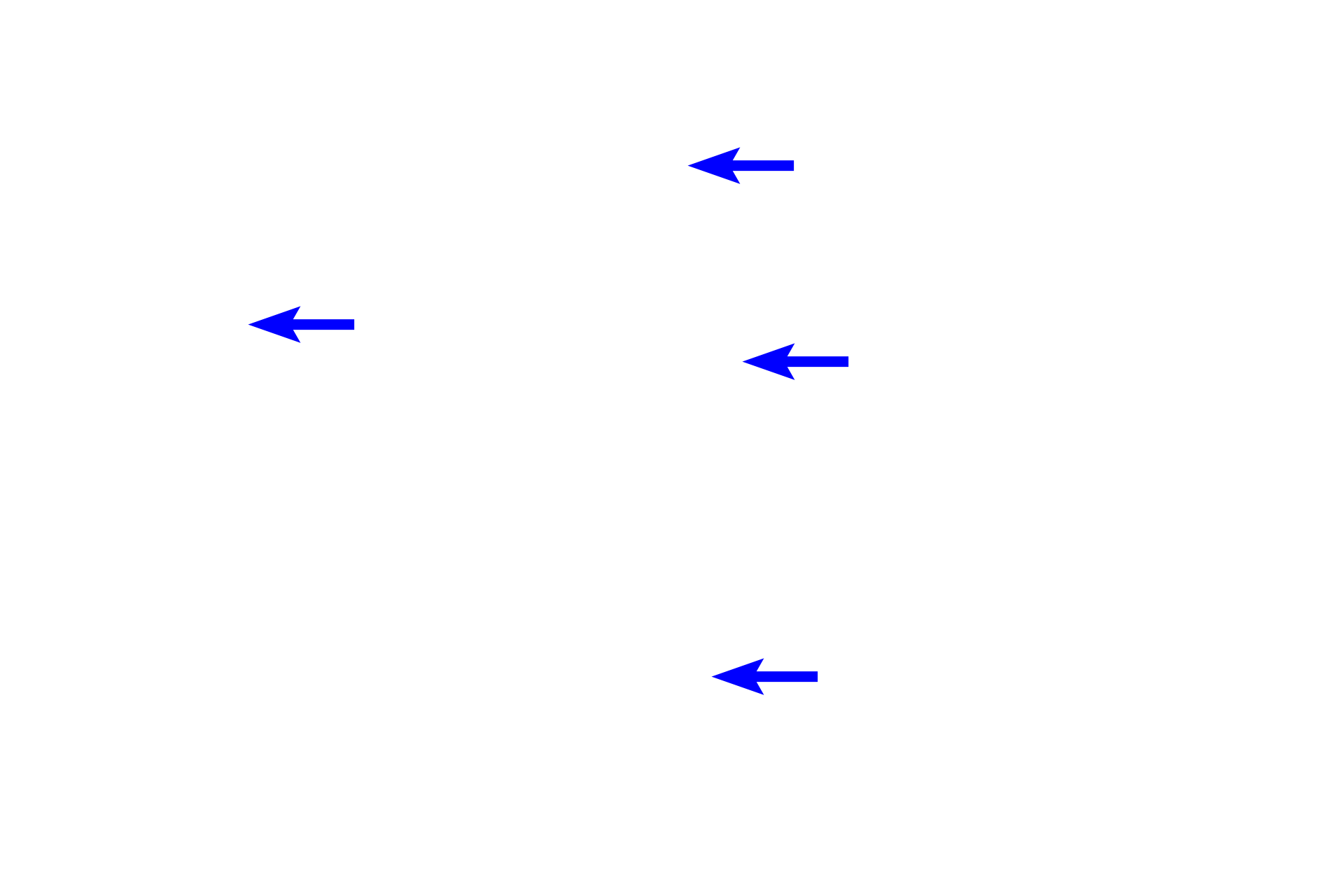 Muscle fibers <p>A single fascicle of skeletal muscle in the tongue is shown in this image. Each fiber is surrounded by an endomysium, and the entire fascicle is surrounded by perimysium. Fibers of various sizes make up the fascicle. Densely packed myofibrils fill each muscle fiber. 200x</p>
