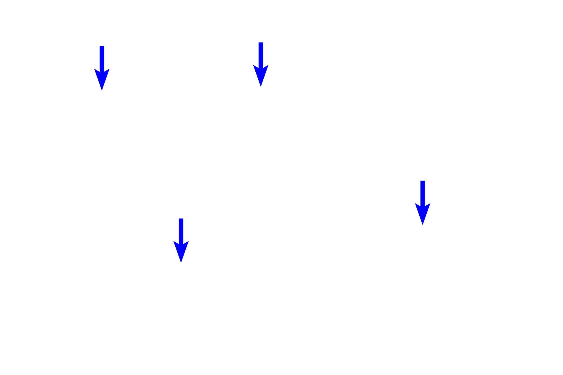  - Peripheral nuclei <p>A single fascicle of skeletal muscle in the tongue is shown in this image. Each fiber is surrounded by an endomysium, and the entire fascicle is surrounded by perimysium. Fibers of various sizes make up the fascicle. Densely packed myofibrils fill each muscle fiber. 200x</p>

