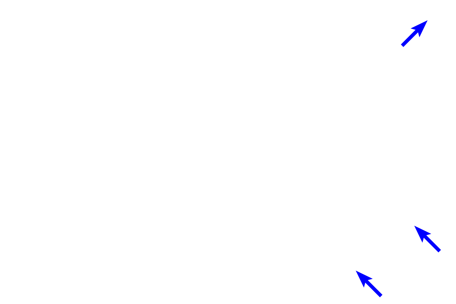 Perimysium <p>A single fascicle of skeletal muscle in the tongue is shown in this image. Each fiber is surrounded by an endomysium, and the entire fascicle is surrounded by perimysium. Fibers of various sizes make up the fascicle. Densely packed myofibrils fill each muscle fiber. 200x</p>
