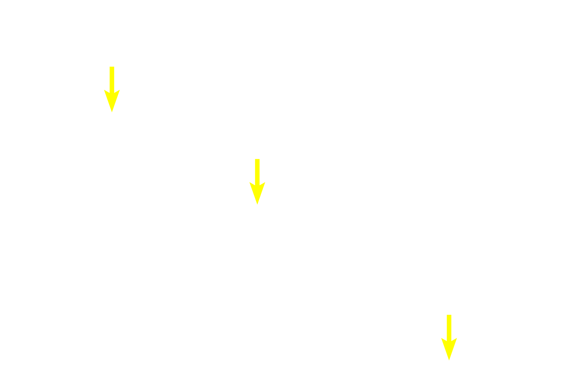 Capillaries <p>A cross section of skeletal muscle displays large, cylindrical fibers with multiple, peripherally located nuclei, a feature which is diagnostic for skeletal muscle. Each fiber contains densely packed myofibrils. 400x</p>
