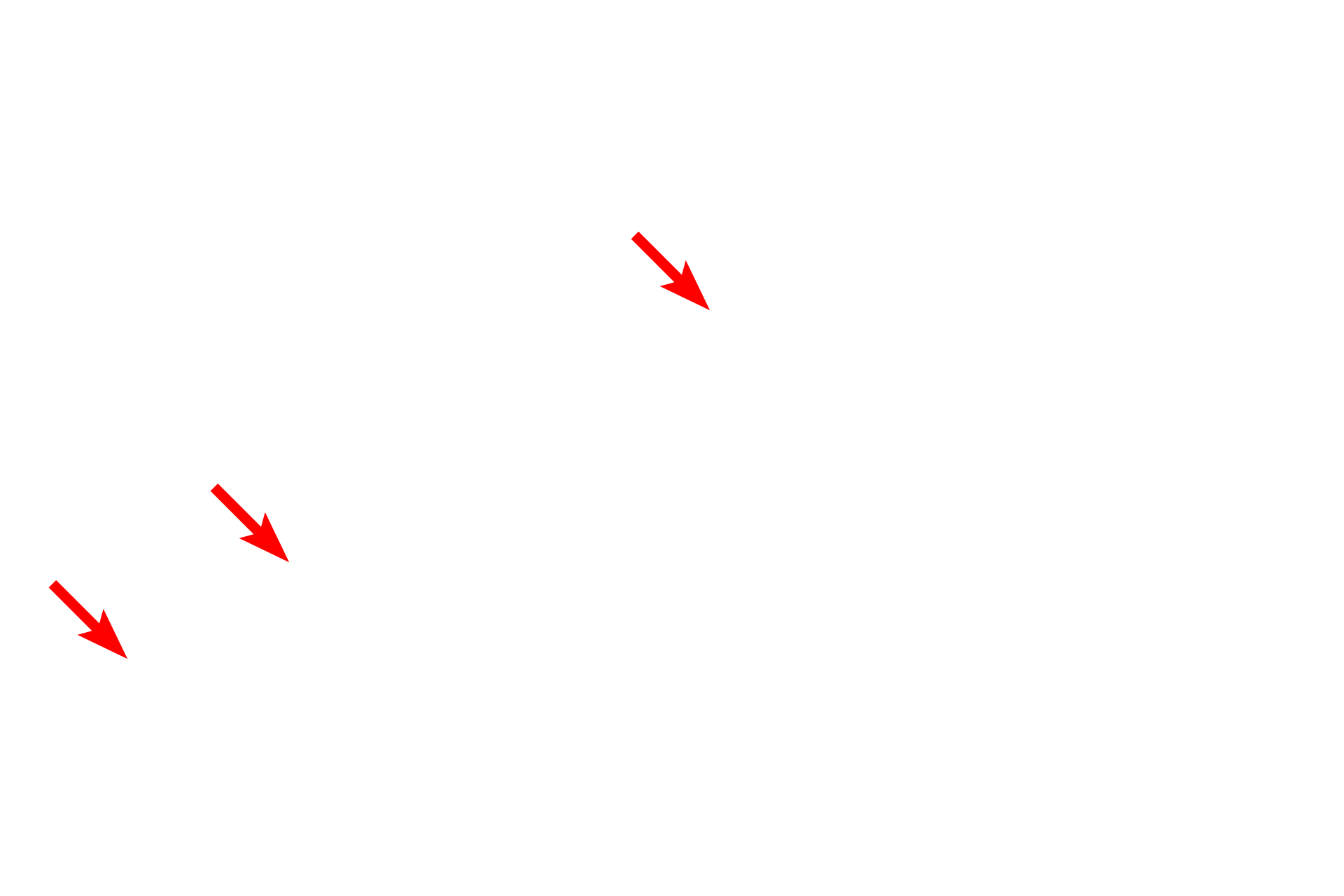 Cytoplasm <p>This image shows an electron micrograph of a squamous cell which lines body cavities.  The cell has very little cytoplasm; note how the nucleus conforms to the shape of the cell.  At its thinnest point, this cell is only 0.5 microns thick.  Serous membrane  15,000x</p>
