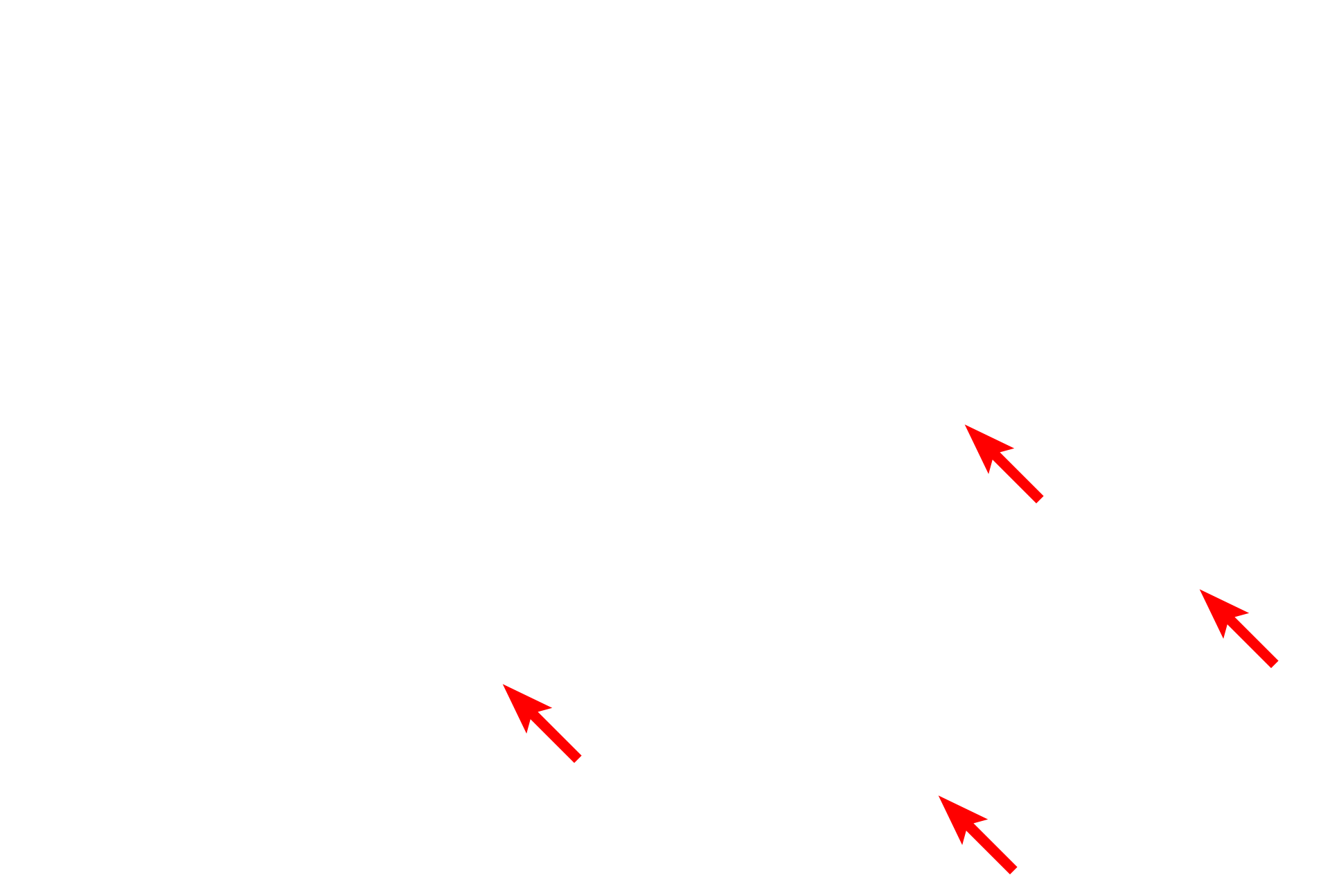 Collagen fibrils <p>This image shows an electron micrograph of a squamous cell which lines body cavities.  The cell has very little cytoplasm; note how the nucleus conforms to the shape of the cell.  At its thinnest point, this cell is only 0.5 microns thick.  Serous membrane  15,000x</p>
