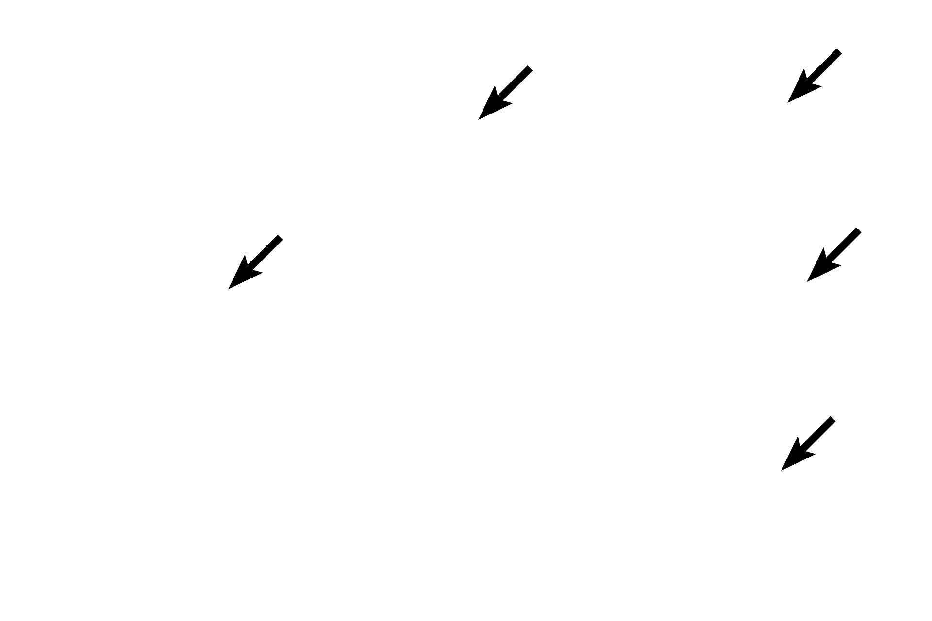 Squamous cells <p>In the lining epithelium of the esophagus, squamous cells are present in multiple layers.  They function to resist abrasion by sloughing off without damage to the underlying tissue.  Note how the rounded basal cells become flattened as they reach the surface and how the shape of the nucleus conforms to the shape of each cell.  1000x</p>
