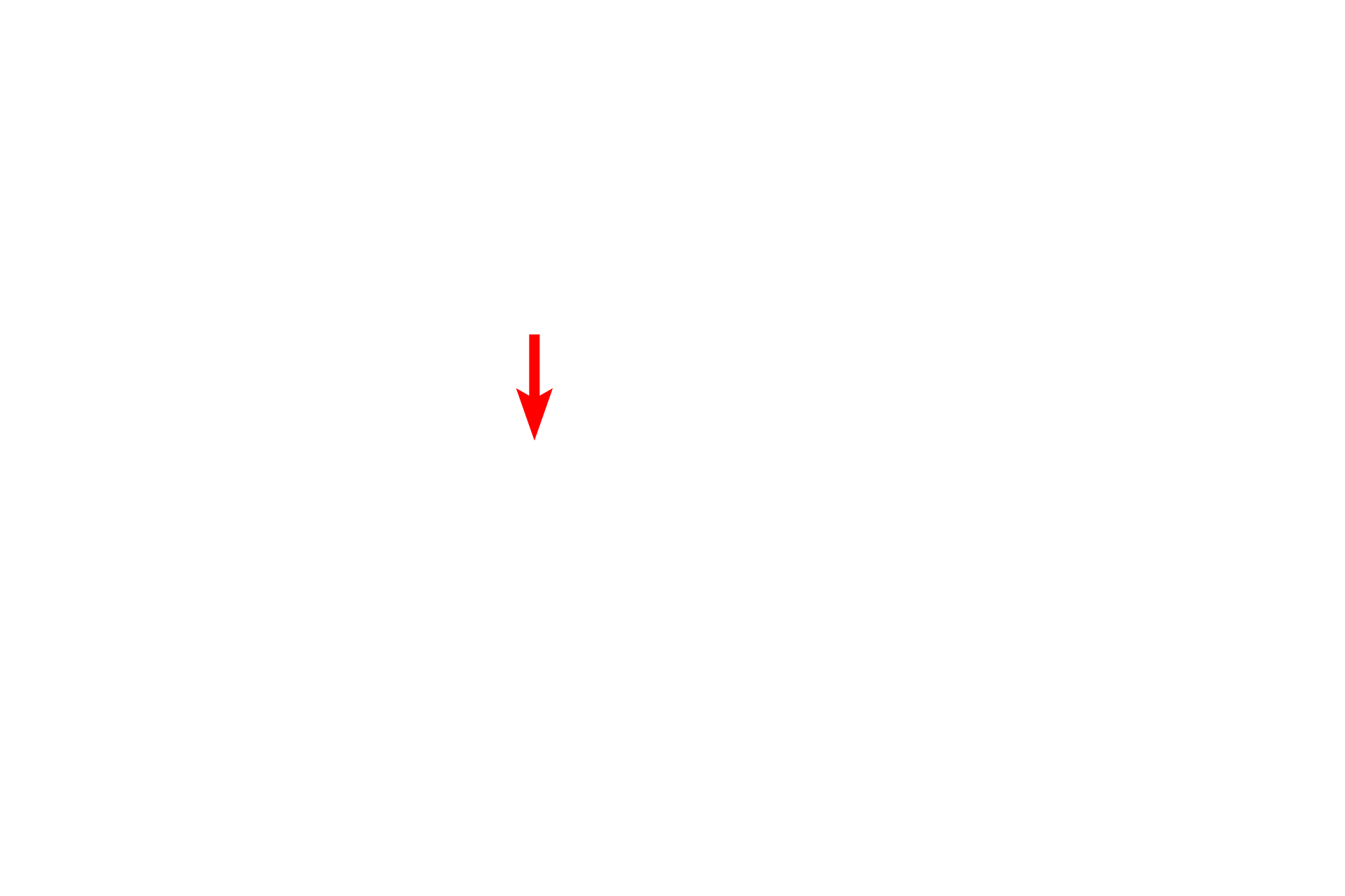  - Nucleus <p>A stellate, or star-shaped nerve cell (multipolar neuron) has numerous long processes emanating from the cell body, with its nucleus and nucleolus.  The cytoplasm is filled with clumps of RER and polysomes called Nissl bodies. The numerous processes provide impulse conduction between multiple cells.  Spinal cord  400x</p>
