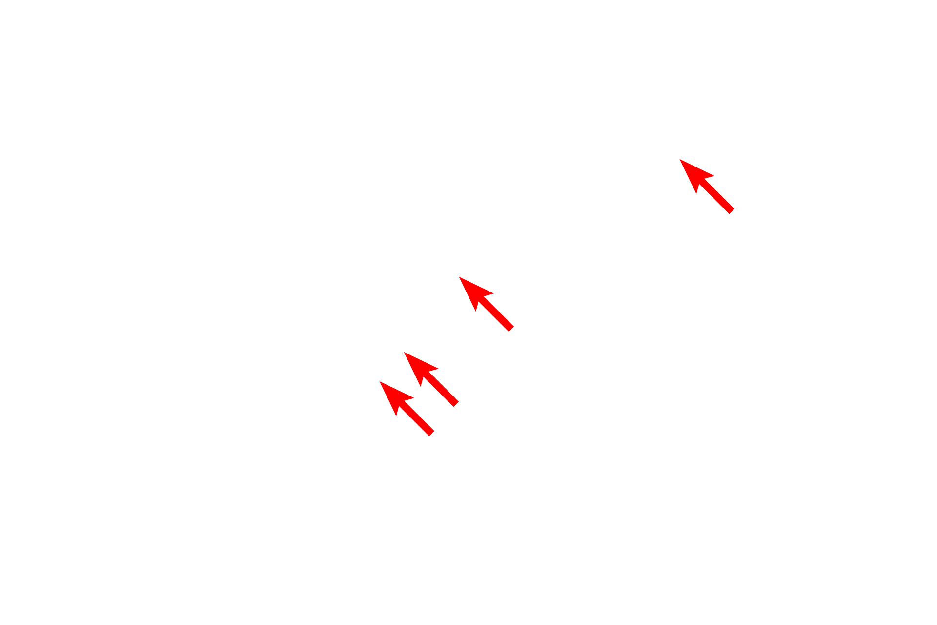  - Nissl bodies <p>A stellate, or star-shaped nerve cell (multipolar neuron) has numerous long processes emanating from the cell body, with its nucleus and nucleolus.  The cytoplasm is filled with clumps of RER and polysomes called Nissl bodies. The numerous processes provide impulse conduction between multiple cells.  Spinal cord  400x</p>
