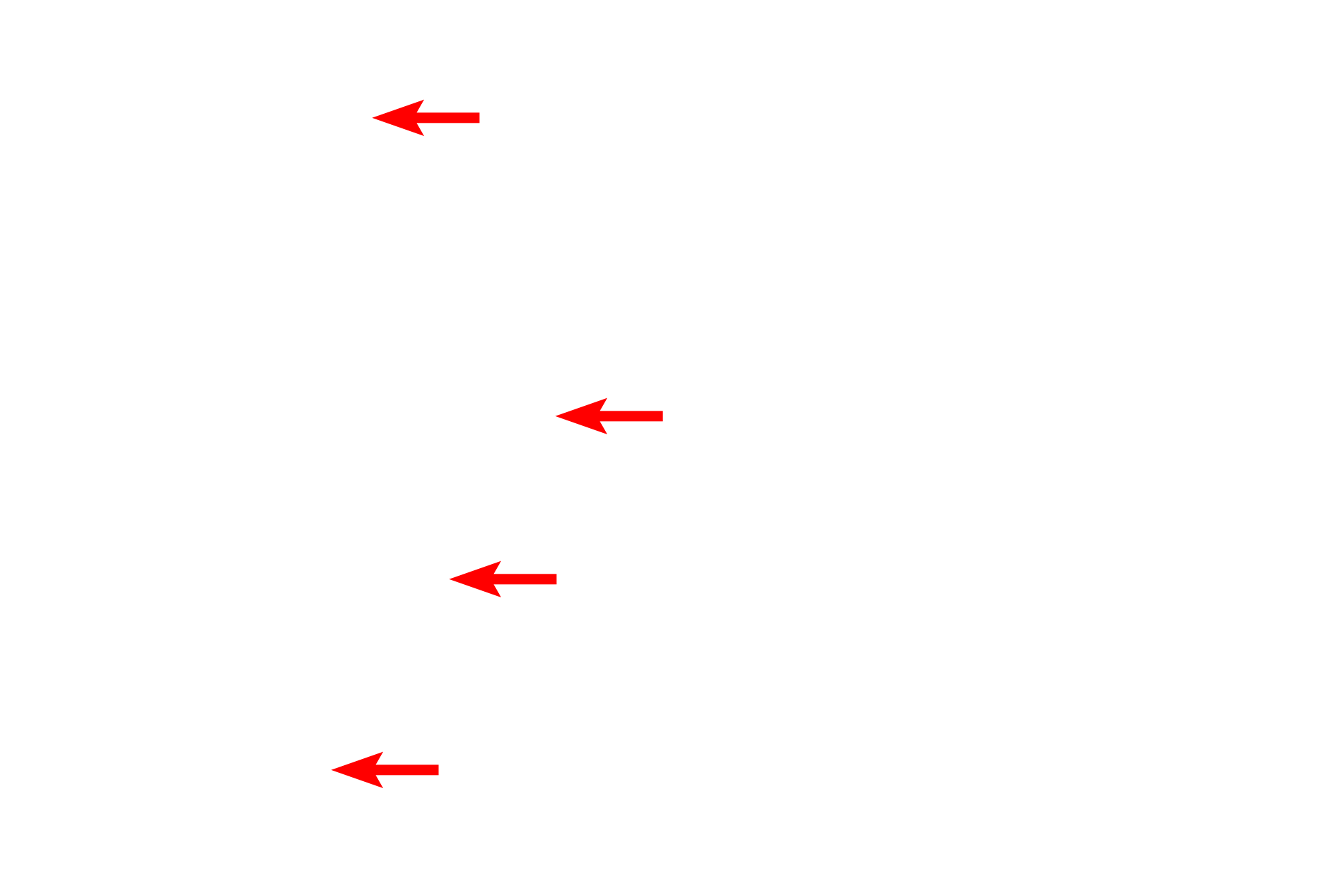 Elastic fibers <p>This complex stain utilizes five dyes to reveal the different components of tissue. With this stain, elastic fibers stain black; collagen and reticular fibers stain yellow; tissue ground substance stains blue; and cytoplasm stains red. This section of skin demonstrates this dramatic staining pattern. 200x</p>
