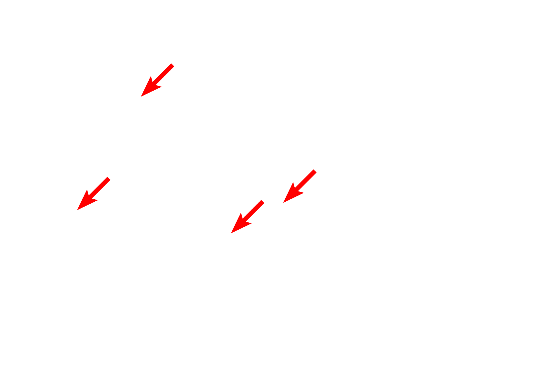 Collagen fibers <p>This complex stain utilizes five dyes to reveal the different components of tissue. With this stain, elastic fibers stain black; collagen and reticular fibers stain yellow; tissue ground substance stains blue; and cytoplasm stains red. This section of skin demonstrates this dramatic staining pattern. 200x</p>

