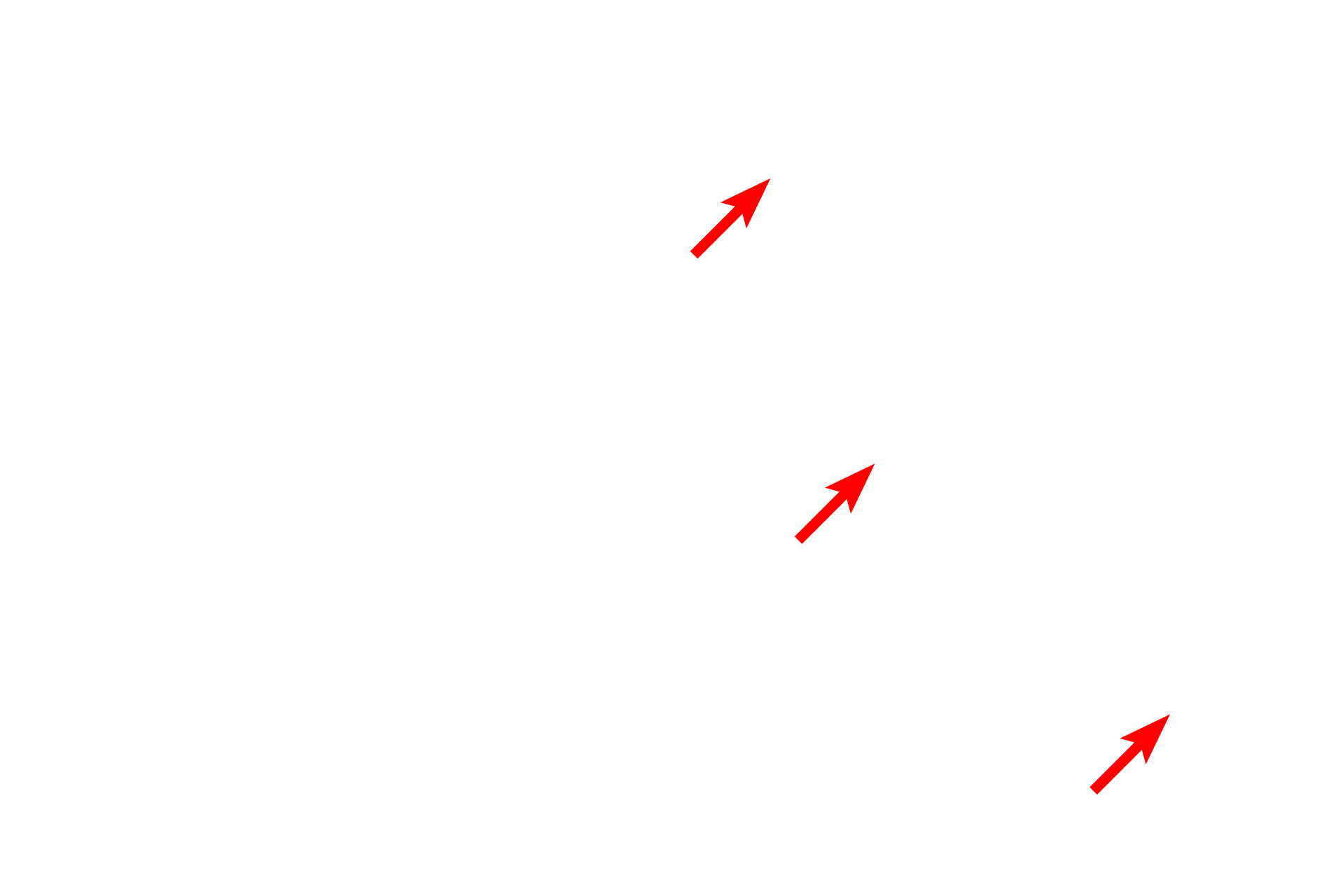 Cytoplasm <p>This complex stain utilizes five dyes to reveal the different components of tissue. With this stain, elastic fibers stain black; collagen and reticular fibers stain yellow; tissue ground substance stains blue; and cytoplasm stains red. This section of skin demonstrates this dramatic staining pattern. 200x</p>
