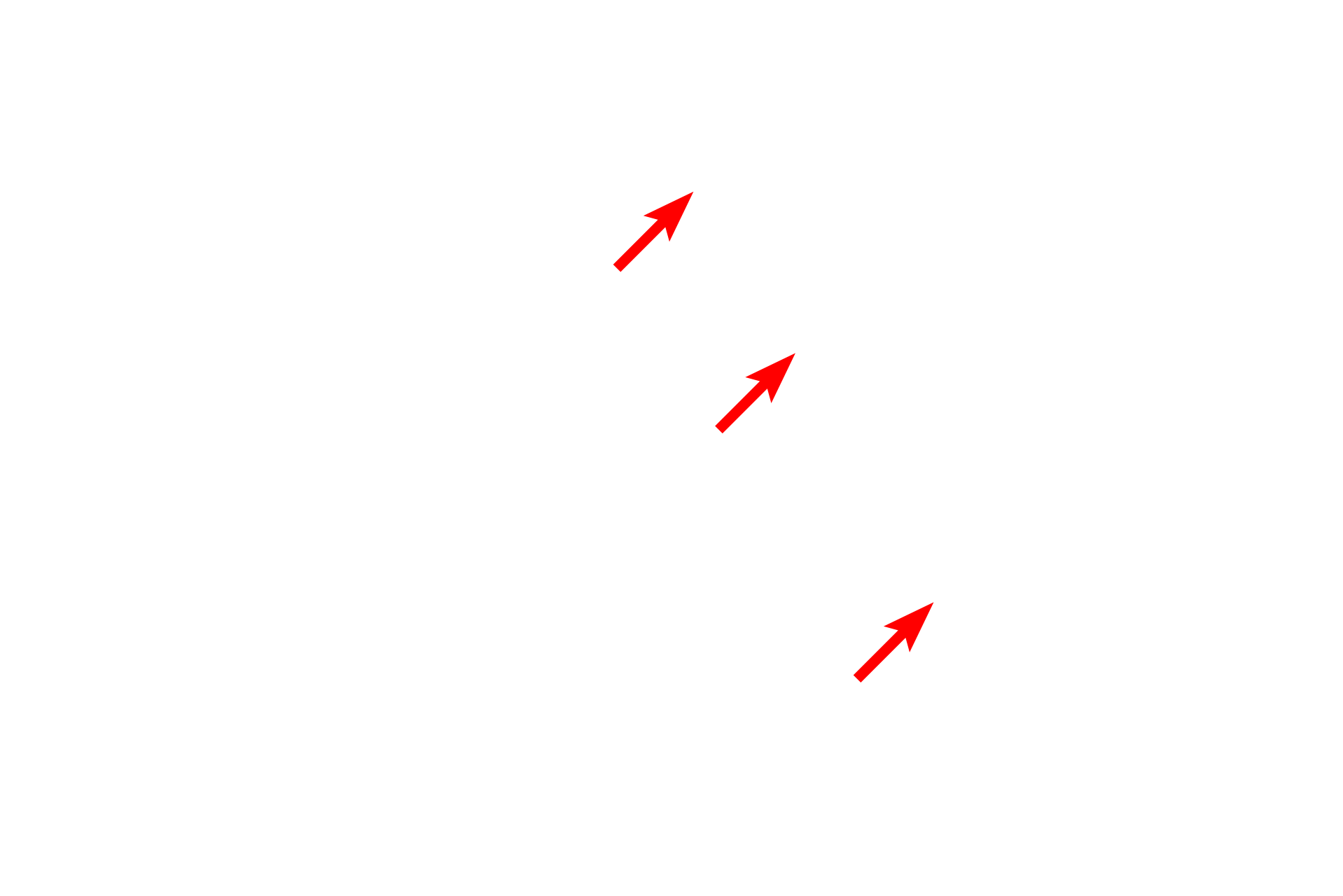 Melanin pigment <p>This complex stain utilizes five dyes to reveal the different components of tissue. With this stain, elastic fibers stain black; collagen and reticular fibers stain yellow; tissue ground substance stains blue; and cytoplasm stains red. This section of skin demonstrates this dramatic staining pattern. 200x</p>

