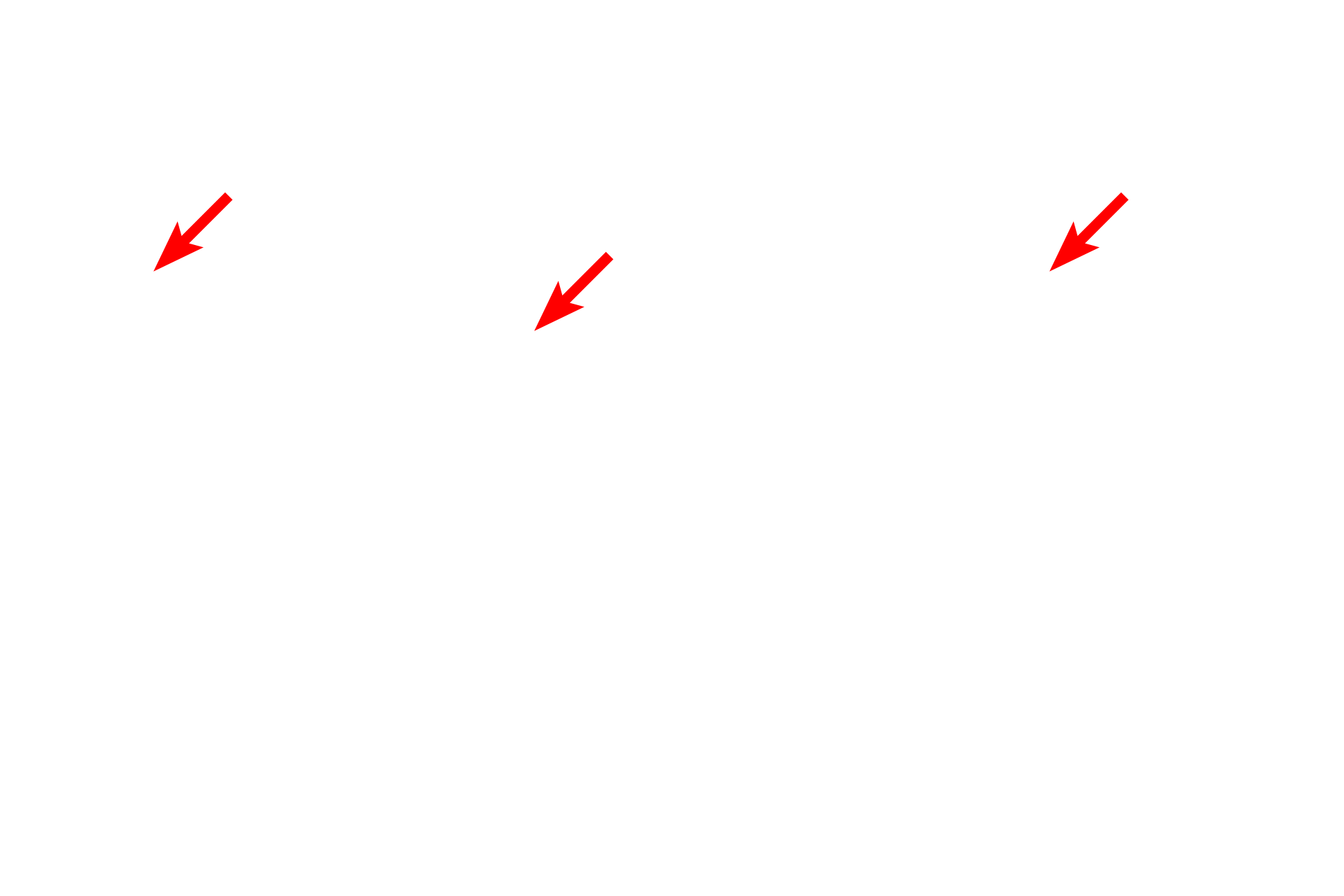 Electron dense > <p>Areas that bind the metal appear dark and are referred to as electron dense.  Where very little of the metal binds, the electrons pass freely through the section, producing a light, or electron lucent area.</p>
