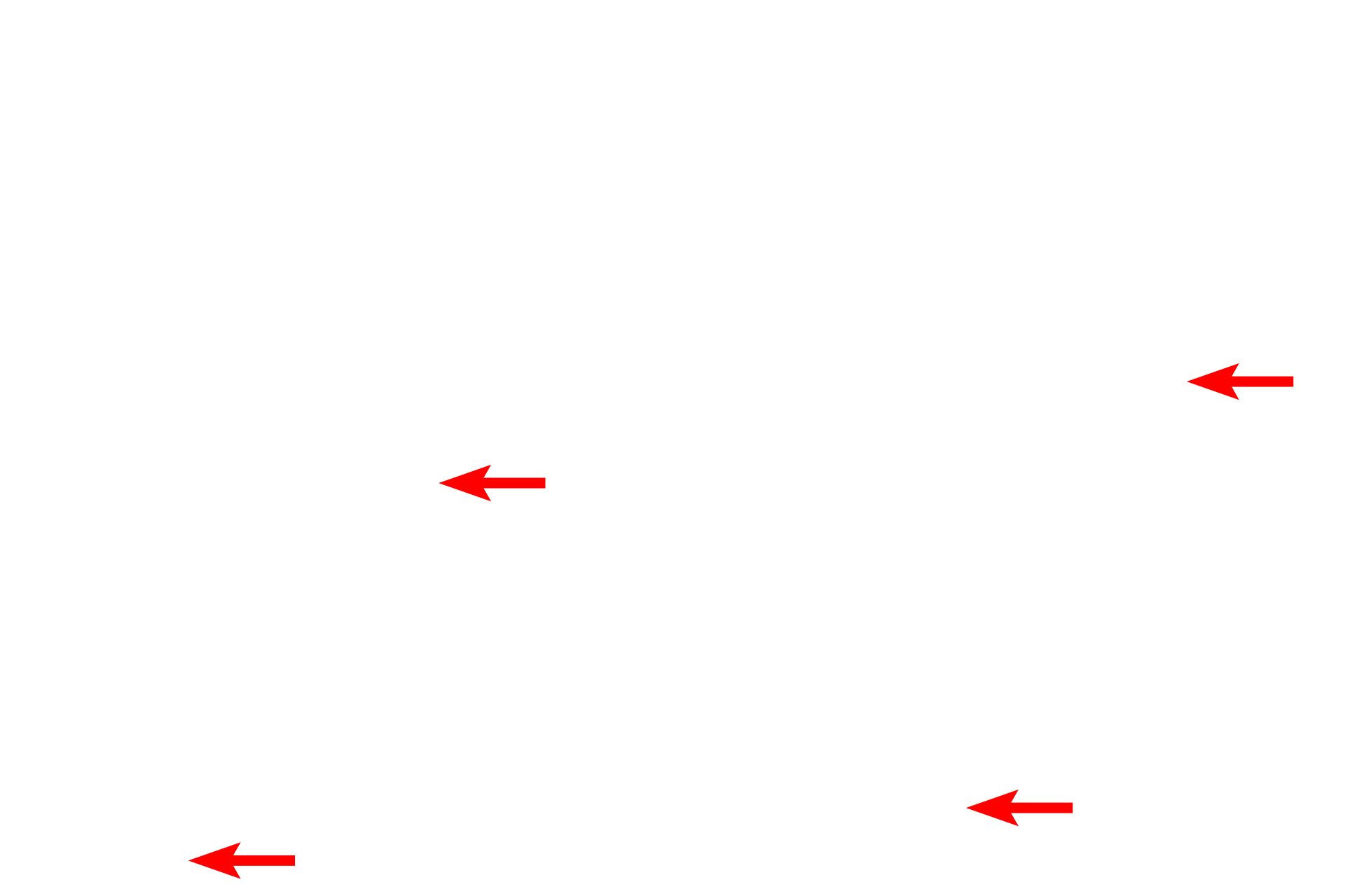 Electron lucent <p>Areas that bind the metal appear dark and are referred to as electron dense.  Where very little of the metal binds, the electrons pass freely through the section, producing a light, or electron lucent area.</p>
