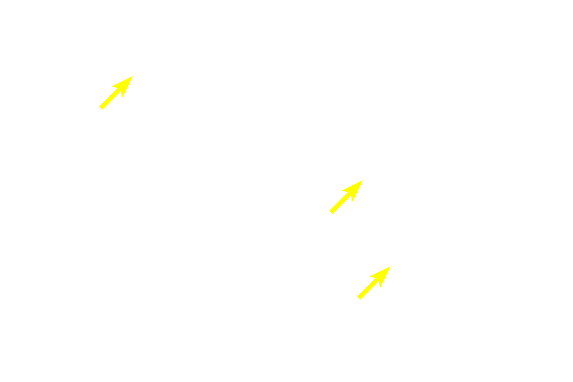 Lipid droplets <p>Osmium tetroxide is both a stain and a fixative for lipid. At the light microscopic level, as seen here, the reaction of osmium with lipid produces a brown color. Osmium is also routinely used to preserve lipid during tissue preparation for electron microscopy, where it also provides additional electron density to the tissue. Toluidine blue stain of oviduct 1000x</p>
