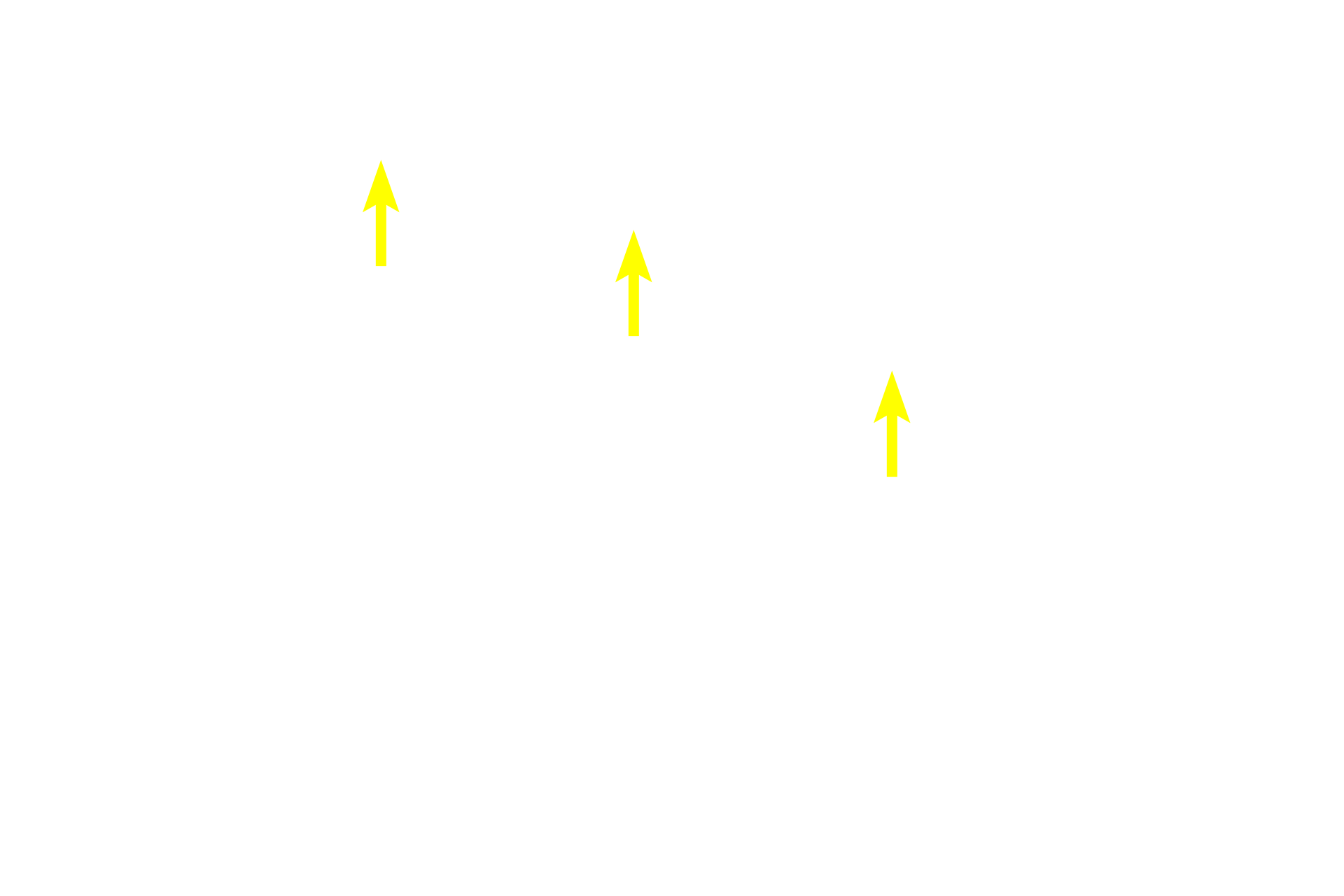 Cytoplasm <p>Osmium tetroxide is both a stain and a fixative for lipid. At the light microscopic level, as seen here, the reaction of osmium with lipid produces a brown color. Osmium is also routinely used to preserve lipid during tissue preparation for electron microscopy, where it also provides additional electron density to the tissue. Toluidine blue stain of oviduct 1000x</p>
