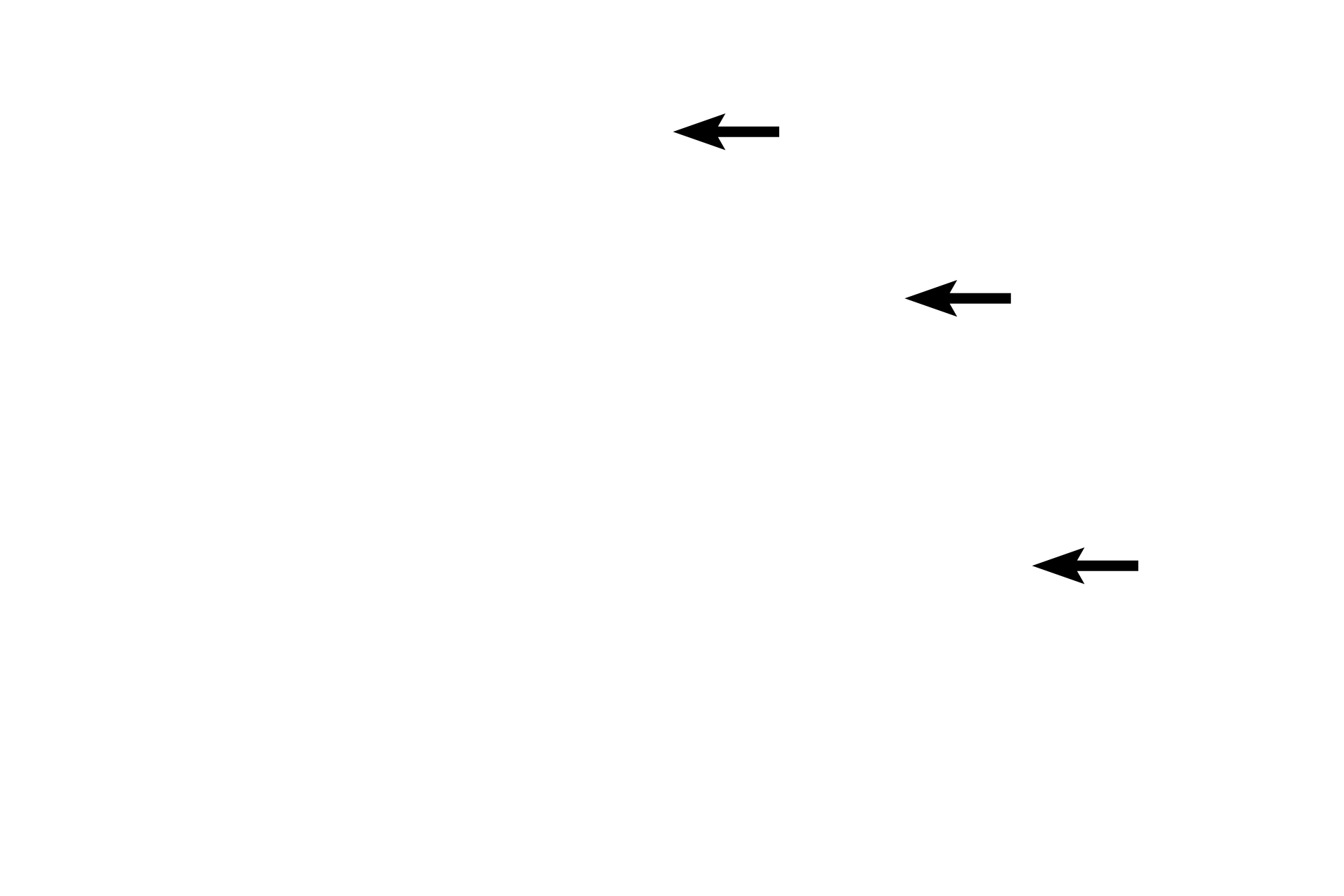Cilia <p>Osmium tetroxide is both a stain and a fixative for lipid. At the light microscopic level, as seen here, the reaction of osmium with lipid produces a brown color. Osmium is also routinely used to preserve lipid during tissue preparation for electron microscopy, where it also provides additional electron density to the tissue. Toluidine blue stain of oviduct 1000x</p>
