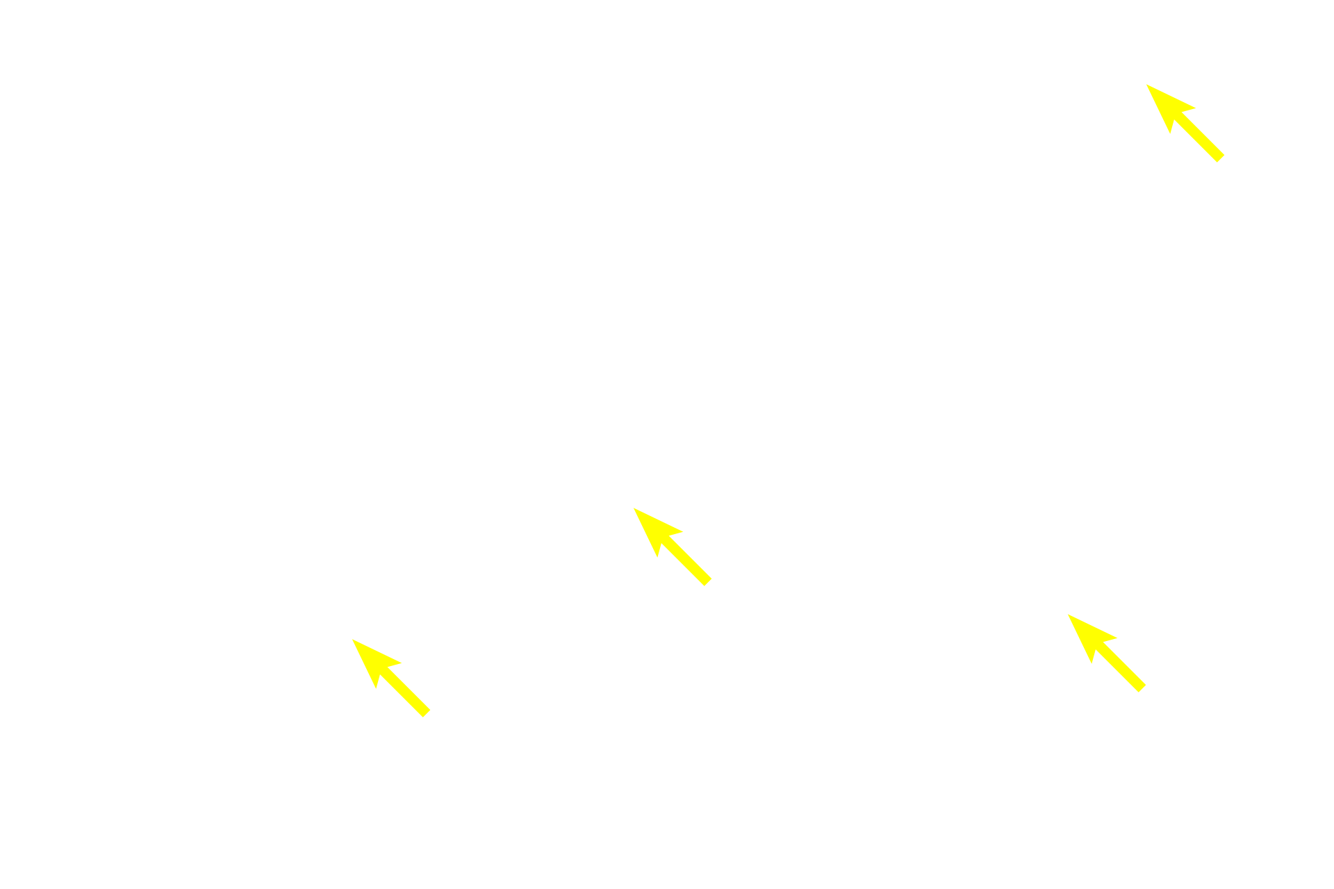 Glycogen <p>PAS is an example of a histochemical stain, that localizes a unique chemical group, in this case, carbohydrate.  PAS is thus more precise than a conventional stain which relies on simple charge interactions. The reaction of PAS with carbohydrate produces a magenta color, thus identifying the glycogen deposits in these liver hepatocytes. Liver 1000x</p>
