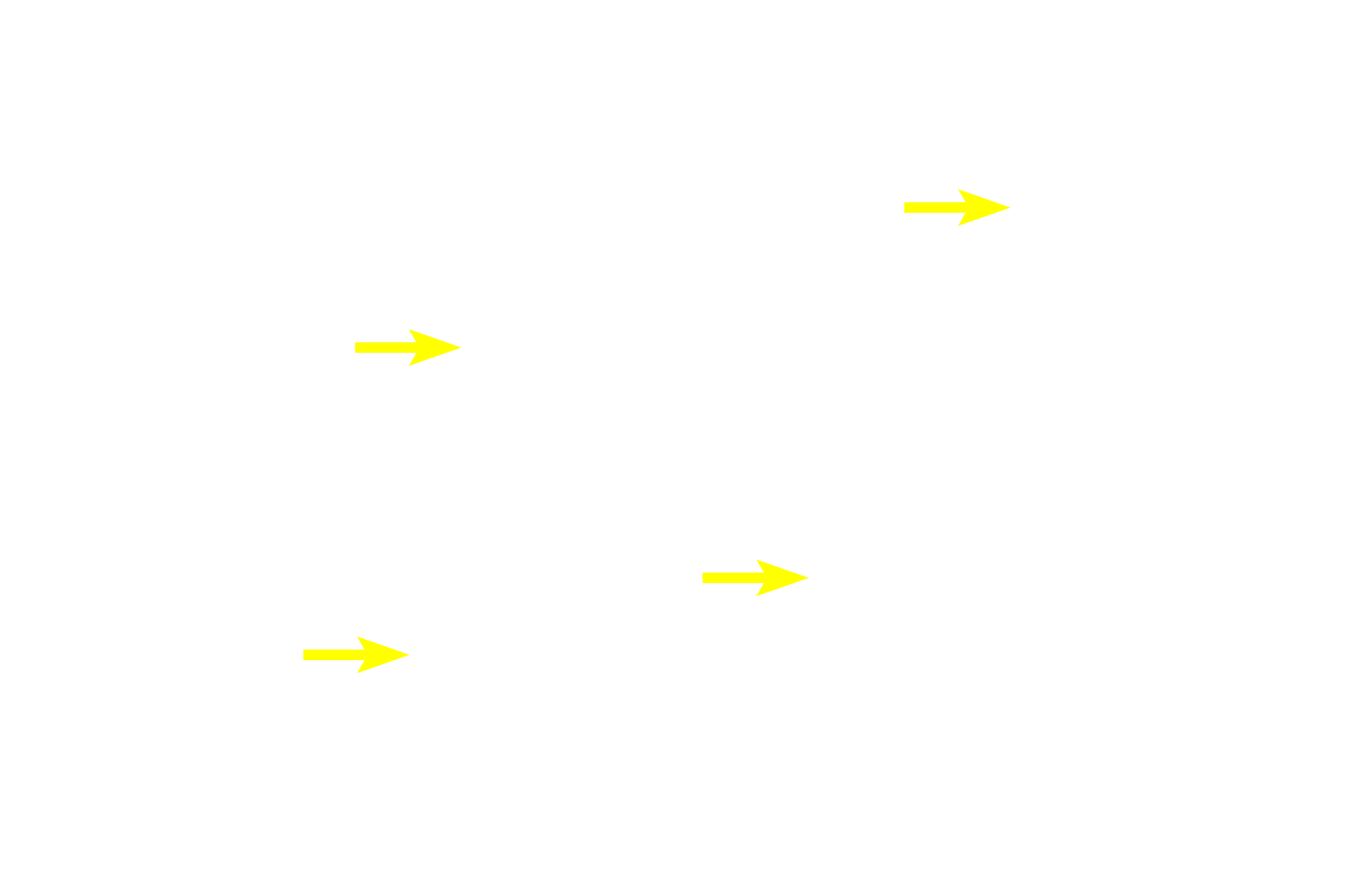 Nuclei <p>PAS is an example of a histochemical stain, that localizes a unique chemical group, in this case, carbohydrate.  PAS is thus more precise than a conventional stain which relies on simple charge interactions. The reaction of PAS with carbohydrate produces a magenta color, thus identifying the glycogen deposits in these liver hepatocytes. Liver 1000x</p>
