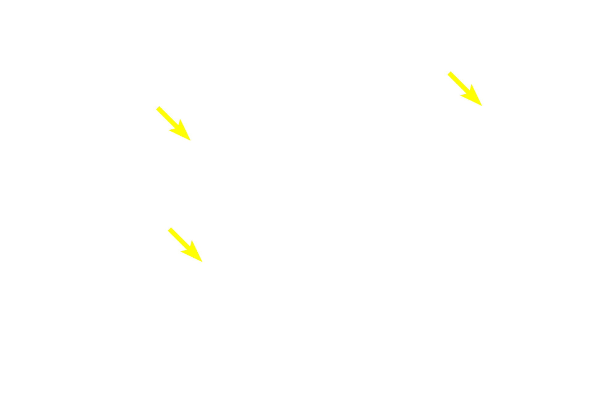 Cytoplasm <p>PAS is an example of a histochemical stain, that localizes a unique chemical group, in this case, carbohydrate.  PAS is thus more precise than a conventional stain which relies on simple charge interactions. The reaction of PAS with carbohydrate produces a magenta color, thus identifying the glycogen deposits in these liver hepatocytes. Liver 1000x</p>
