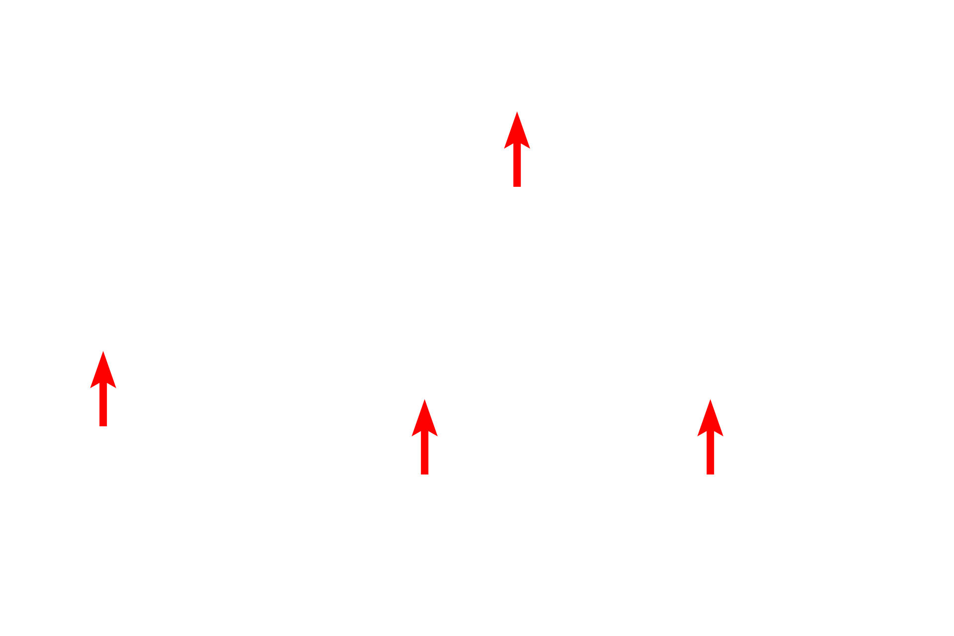 Mucus <p>The Masson’s trichrome stain combines three dyes and is primarily used to reveal the presence of collagen. With this method, collagen stains green and the cytoplasm of cells stains red or purple. The third stain is usually a nuclear counterstain like hematoxylin. Stomach 200x</p>

