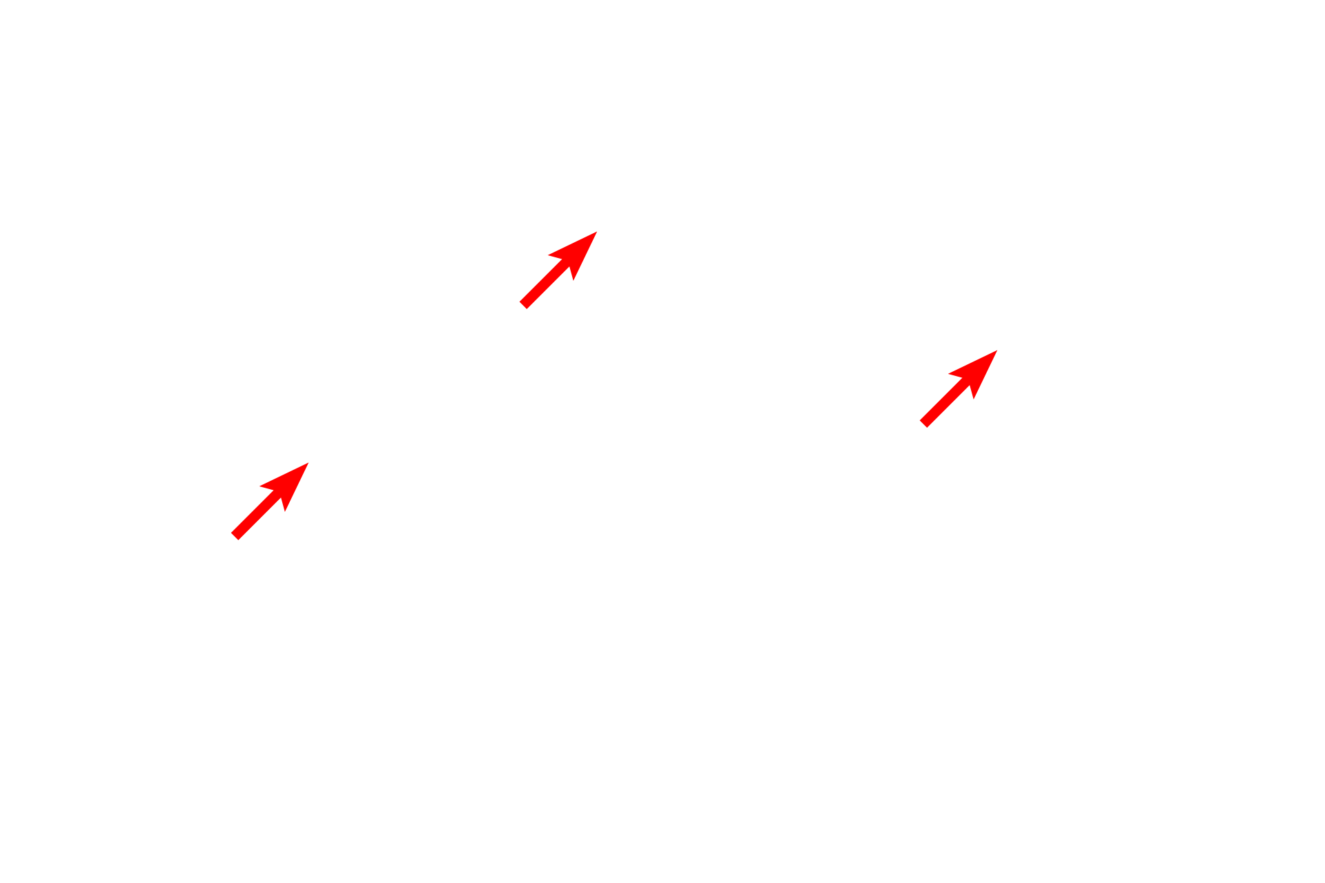 Nuclei <p>The Masson’s trichrome stain combines three dyes and is primarily used to reveal the presence of collagen. With this method, collagen stains green and the cytoplasm of cells stains red or purple. The third stain is usually a nuclear counterstain like hematoxylin. Stomach 200x</p>
