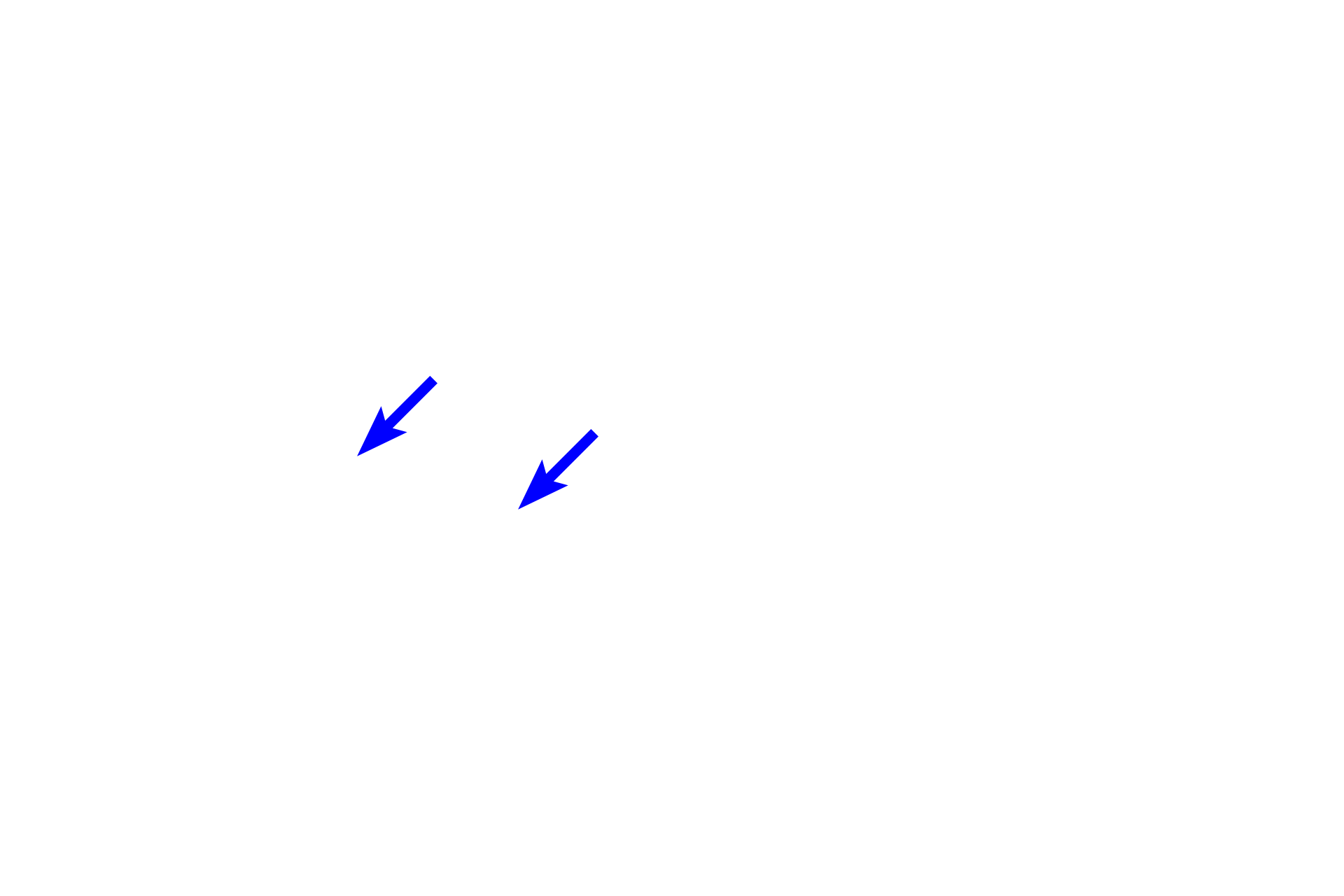 Centromeres > <p>The centromere is a highly condensed region of DNA which forms the junction point for the two sister chromatids.  A protein complex located on the centromere, the kinetochore, provides the attachment point for microtubules of the spindle apparatus.</p>
