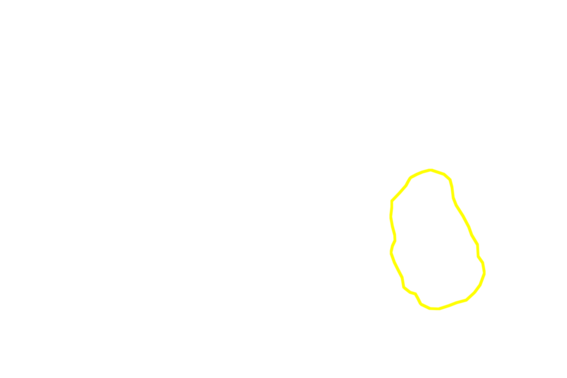 Early anaphase cell <p>Anaphase begins abruptly as sister chromatids separate and are drawn toward opposite poles of the cell.  The movement of the chromatids occurs by the shortening of the spindle fibers and movement of the spindle poles away from each other.  The end of anaphase is marked by the segregation of an identical set of chromosomes at each spindle pole.</p>
