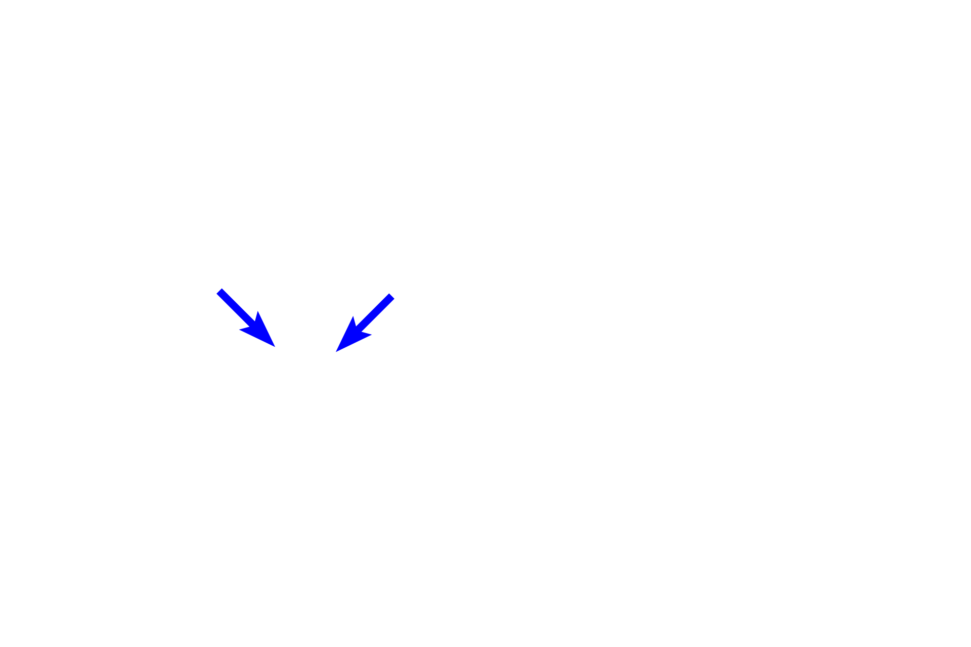 Contractile ring <p>The cleavage furrow, marking the eventual separation site of the daughter cells, is formed by a contractile ring composed of actin and myosin filaments.  Interaction between the filaments tightens the ring and eventually pinches the cell into two daughter cells.</p>
