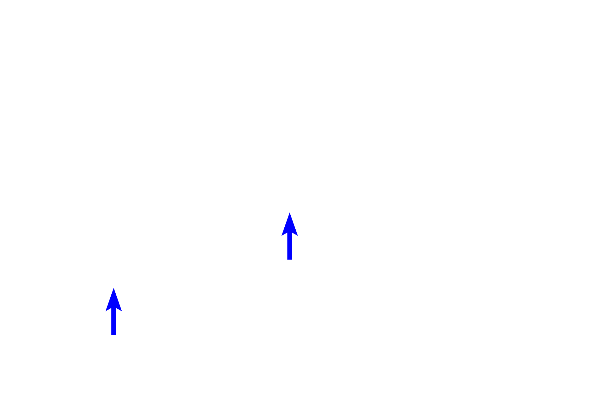 Nucleoli <p>Humans have 23 pairs of chromosomes, 22 pairs of autosomes and one pair of sex chromosomes, XX or XY.  The full complement of 23 pairs of chromosomes is designated 2N.  Note, in this diagram the chromosomes are shown in the condensed state for comparison with the other figures.</p>

