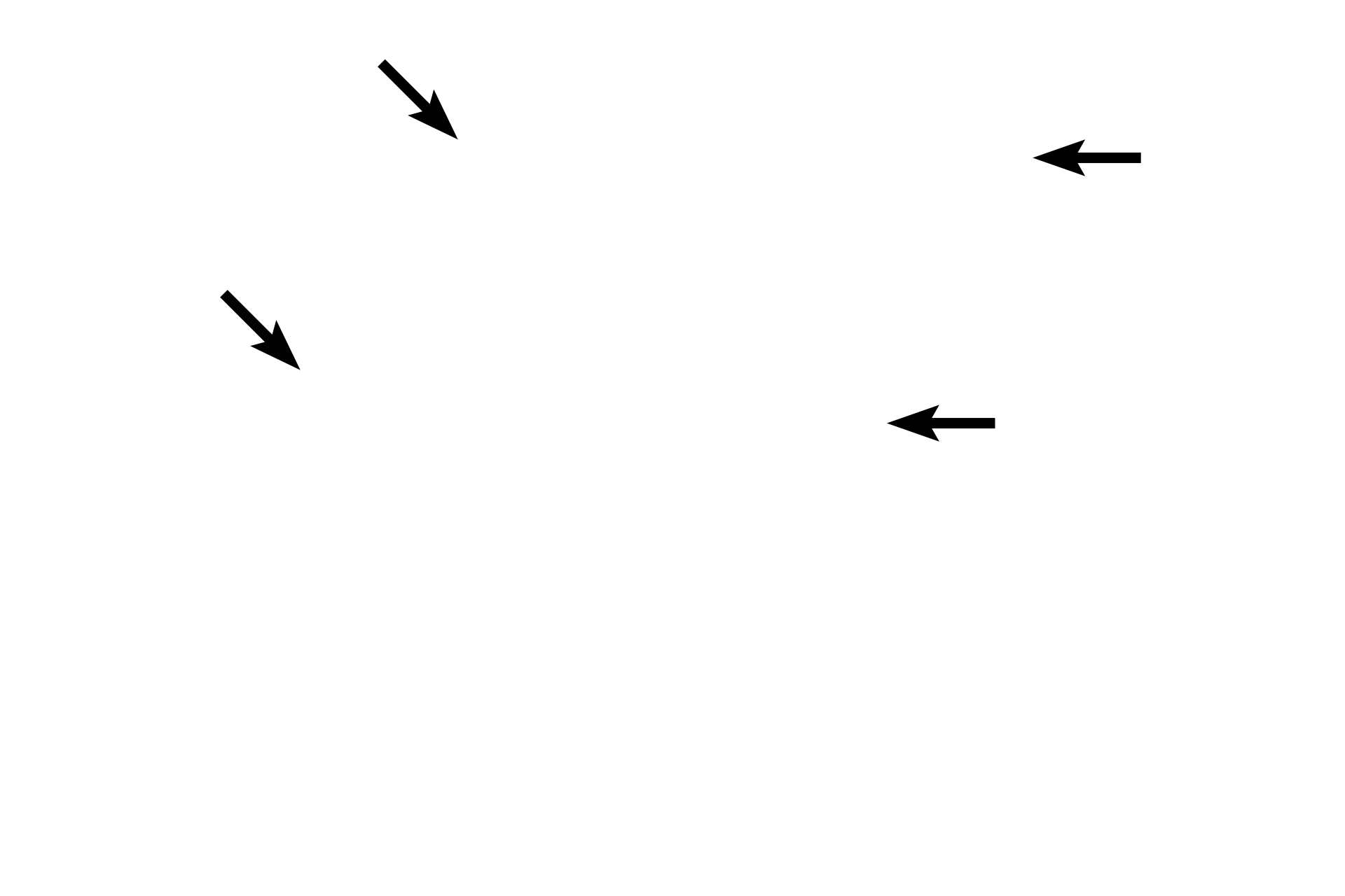 Nuclear envelopes (reforming) <p>Telophase is marked by the arrival of a single set of chromosomes at each spindle pole, reformation of the nuclear envelope, decondensation of the chromosomal DNA and the reappearance of the nucleolus.  A cleavage furrow continues to develop, indicating the initial formation of the daughter cells (cytokinesis).</p>
