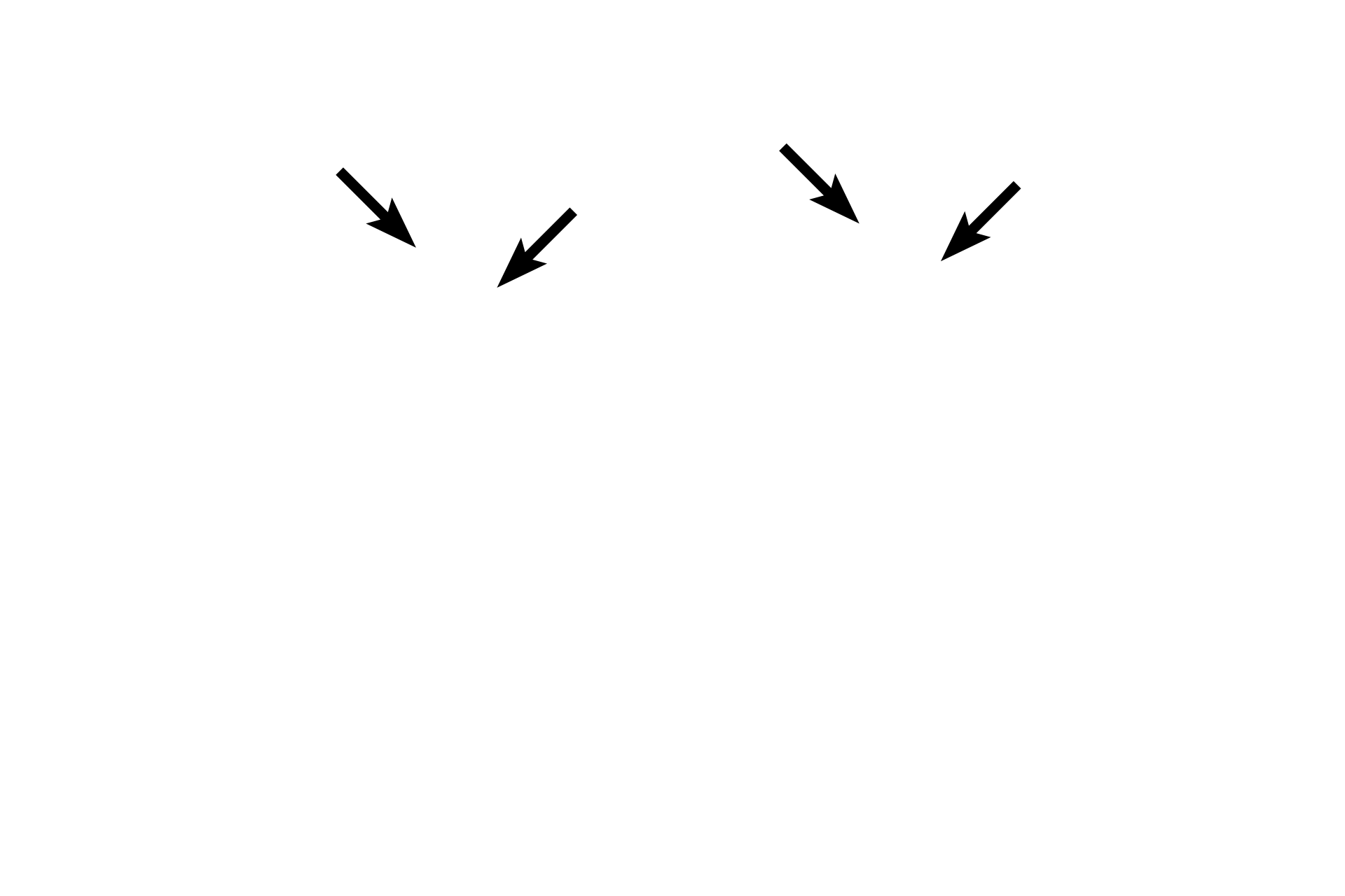 Contractile rings <p>Telophase is marked by the arrival of a single set of chromosomes at each spindle pole, reformation of the nuclear envelope, decondensation of the chromosomal DNA and the reappearance of the nucleolus.  A cleavage furrow continues to develop, indicating the initial formation of the daughter cells (cytokinesis).</p>
