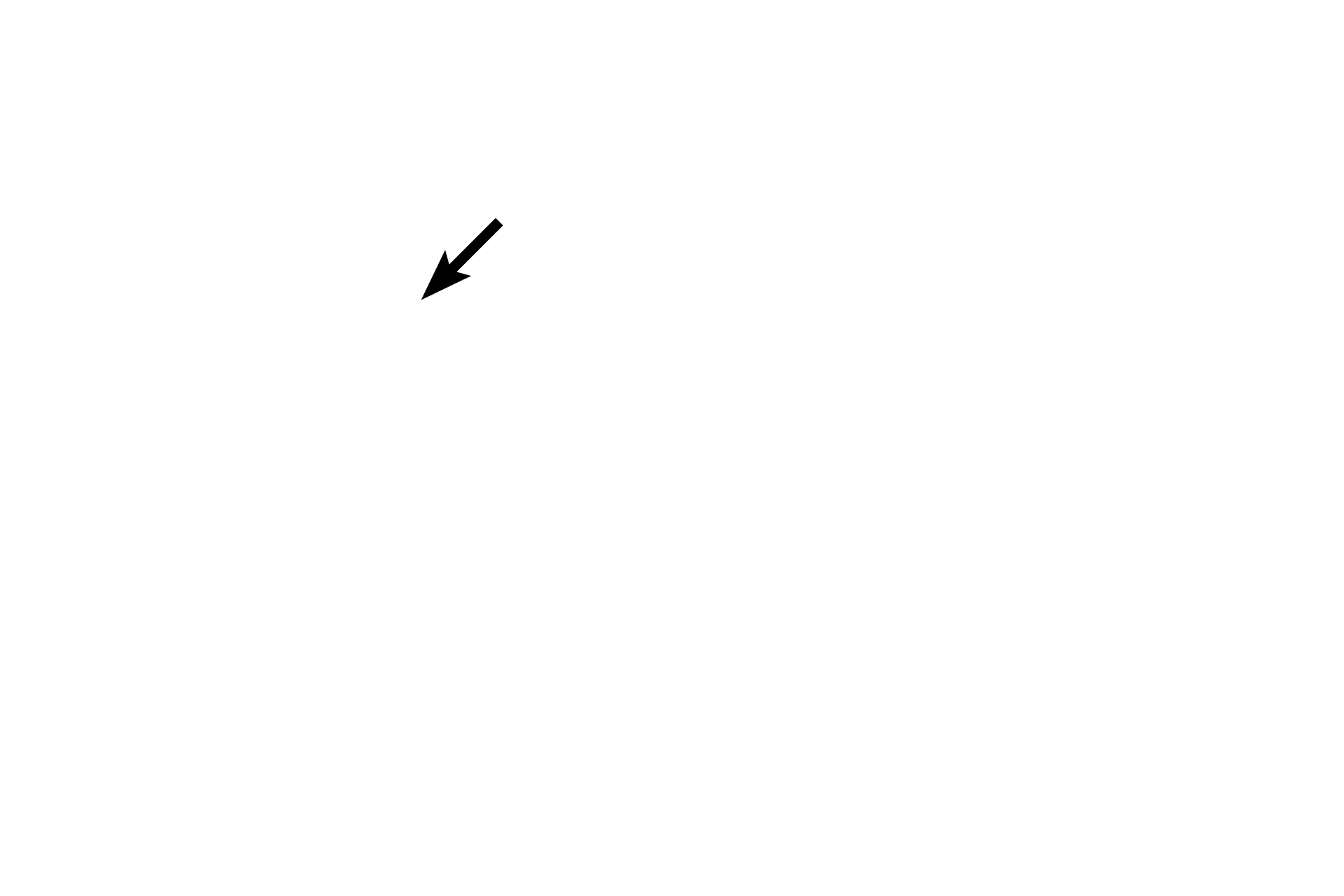 Nucleus > <p>During prophase, chromosomes condense, centrosomes move to opposite poles of the cell, the mitotic spindle assembles and the nuclear envelope and the nucleolus disappear.</p>
