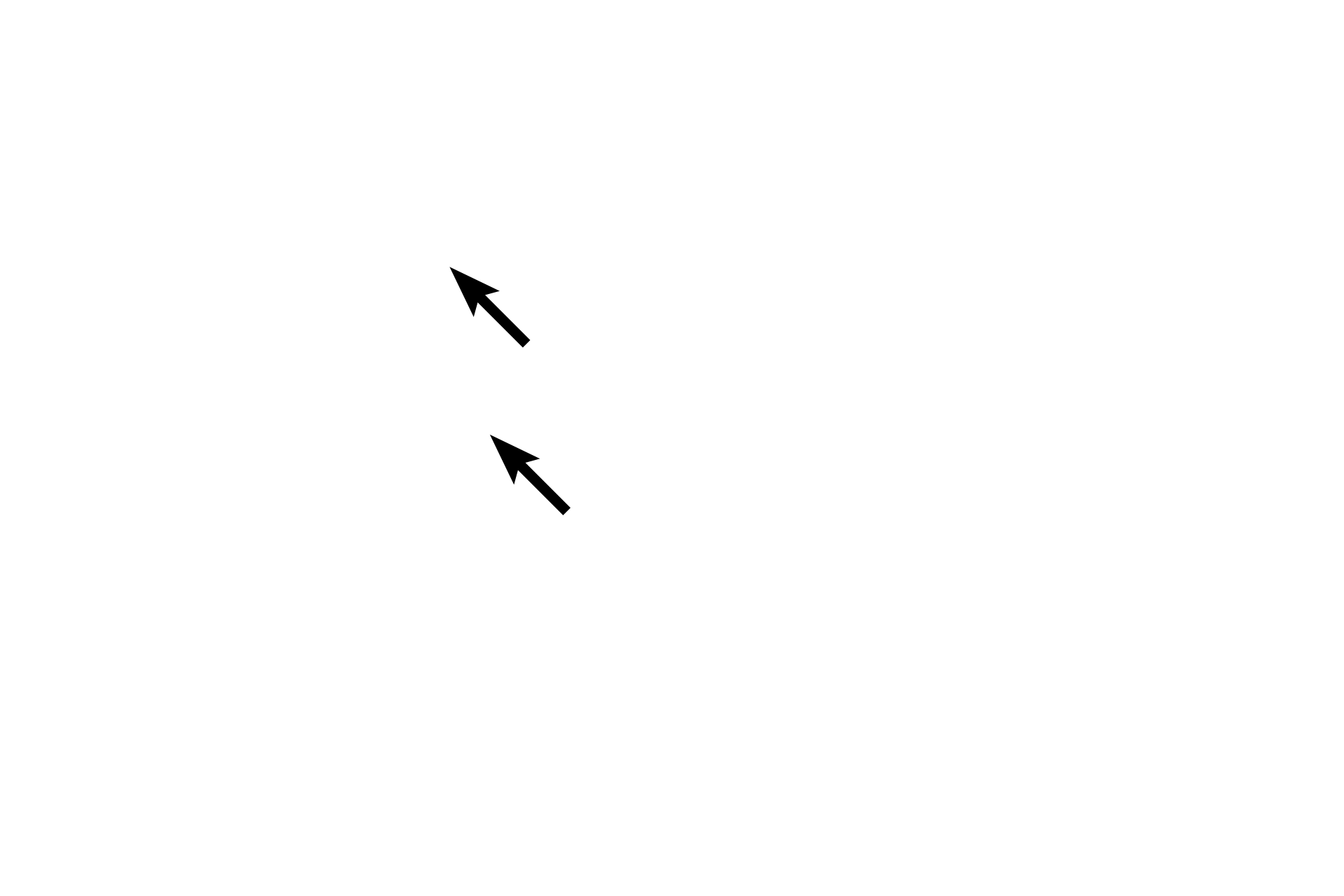Mitotic spindle <p>Anaphase begins as chiasmata break, allowing homologous chromosomes to separate.  Unlike mitosis, sister chromatids remain attached by cohesive proteins at their centromeres, and their kinetochores function together.  Anaphase ends with the segregation of one duplicated chromosome of each homologous pair to each spindle pole.</p>
