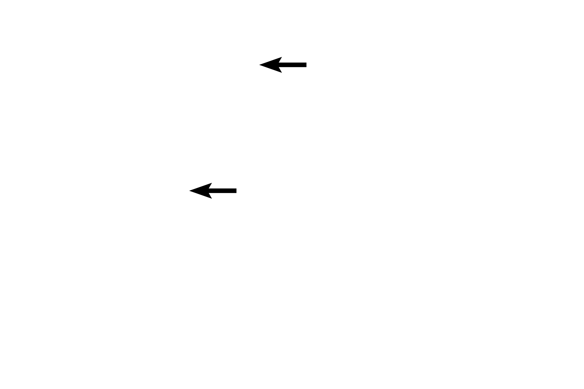 Nuclear envelopes <p>As in mitosis, the nuclear envelope reforms during telophase. The resultant nuclei contain one replicated chromosome of each homologous pair; sister chromatids remain attached.  This separation of a homologous pair reduces the number of chromosomes in daughter cells from 2N (diploid) to 1N (haploid).  Therefore, meiosis I is called the reductional division.</p>
