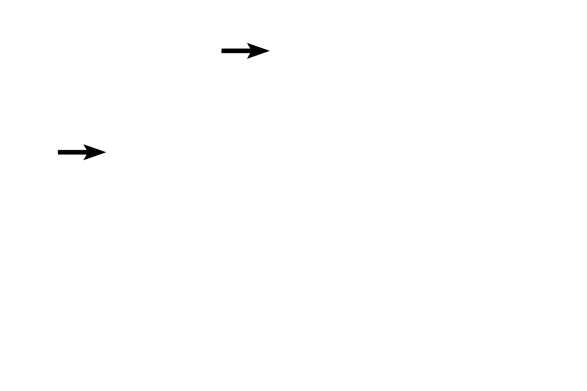 Nuclear envelope <p>Cytokinesis in meiosis I results in the formation of two daughter cells, each with a single set of chromosomes (haploid, 1N).  The nuclear envelope has reformed and chromosomal DNA may decondense somewhat, but quickly recondenses.  Cells rapidly progress into prophase of meiosis II without passing through a second S phase.</p>
