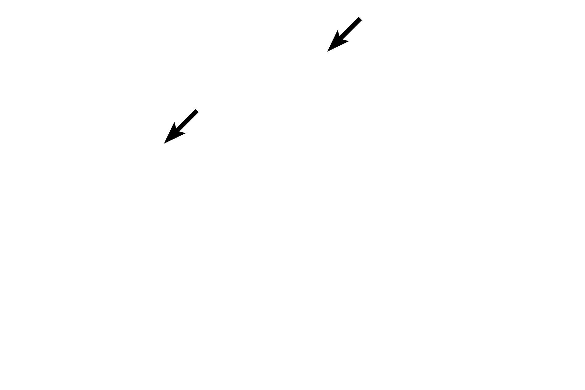 Nuclei <p>Cells enter prophase of meiosis II rapidly after cytokinesis of meiosis I without any intervening DNA synthesis.  The events occurring during prophase of meiosis II parallel those of mitosis.</p>
