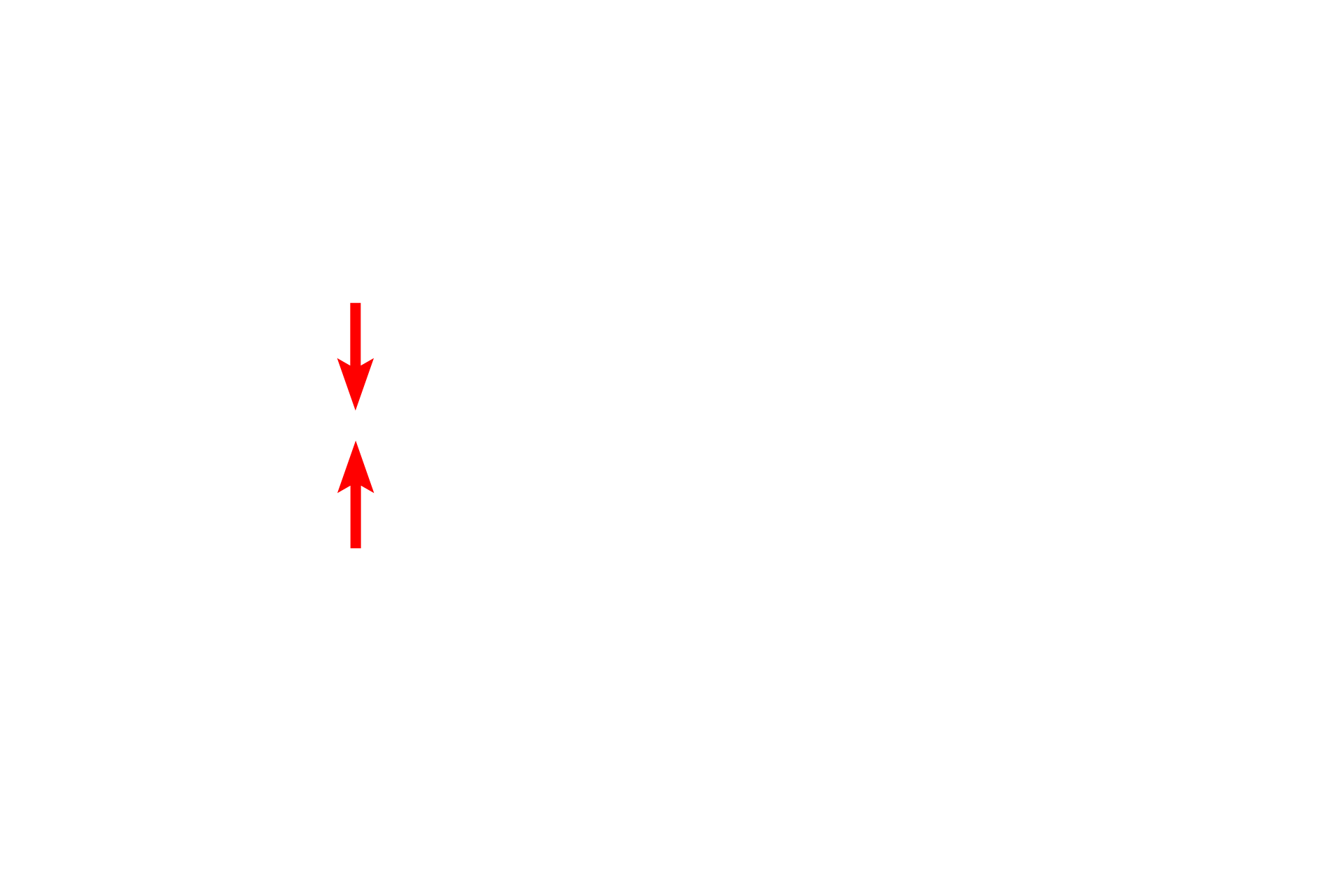 Cytoplasmic bridge <p>These images show two cells in the lining epithelium of the esophagus in the final stages of cytokinesis and telophase.  In the left panel, the daughter cells are still attached by a thin connection, whereas in the right panel, the daughter cells are completely separate.  The chromosomes are decondensing and the nuclear envelopes are reforming. Esophageal epithelium 1000x</p>

