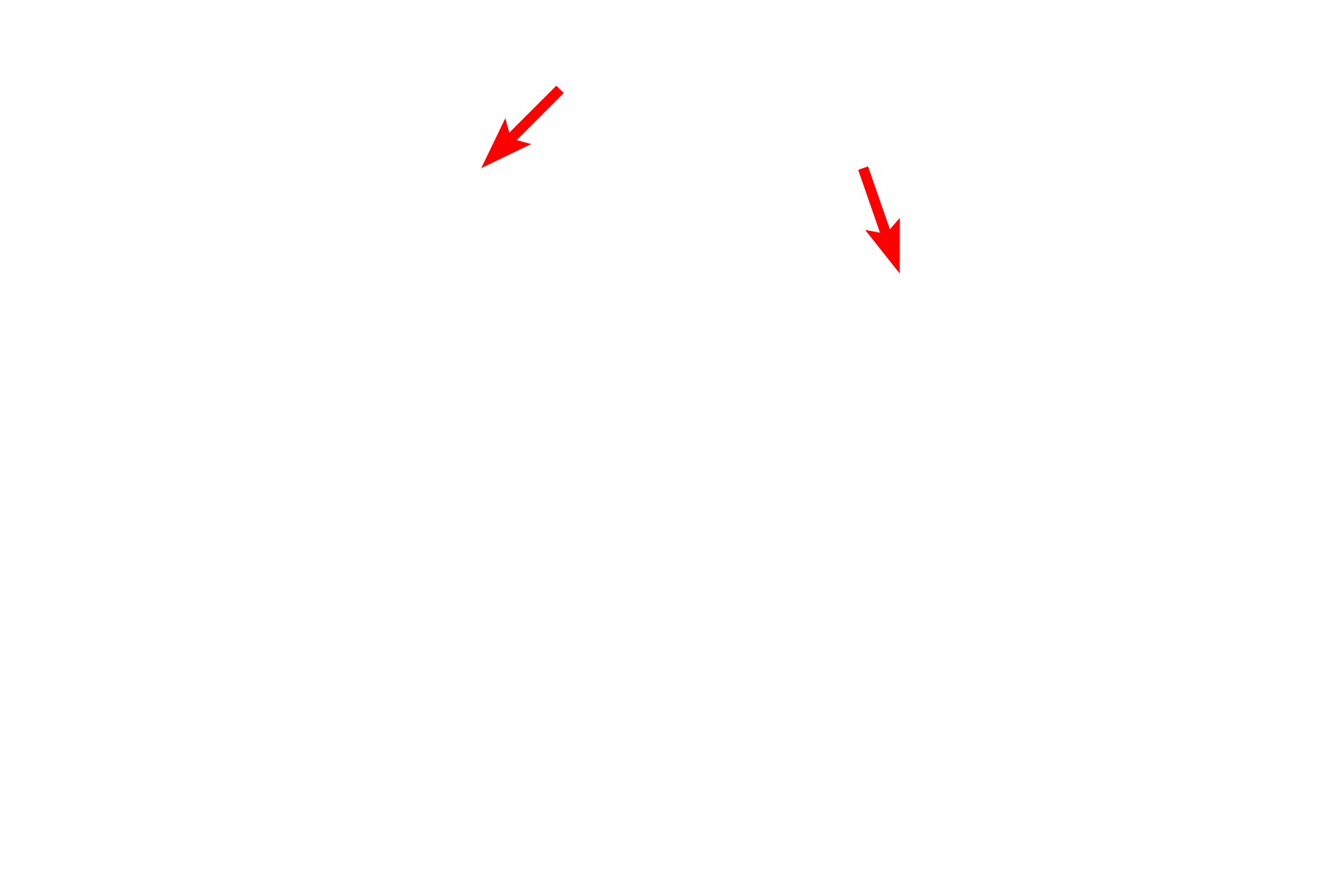 Daughter cells <p>An electron micrograph shows two daughter cells in late telophase and cytokinesis.  The chromosomes are still condensed and the nuclear envelopes have not started to reform.  In the cell on the left, microtubules are seen extending from the centriole to the chromosomes.  Cytokinesis is nearly complete.  Inset: Magnified view of the area in the box.  5000x; Inset   15,000x</p>
