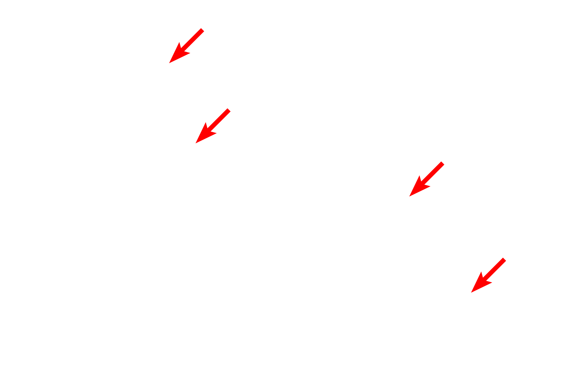 Chromosomes <p>An electron micrograph shows two daughter cells in late telophase and cytokinesis.  The chromosomes are still condensed and the nuclear envelopes have not started to reform.  In the cell on the left, microtubules are seen extending from the centriole to the chromosomes.  Cytokinesis is nearly complete.  Inset: Magnified view of the area in the box.  5000x; Inset   15,000x</p>

