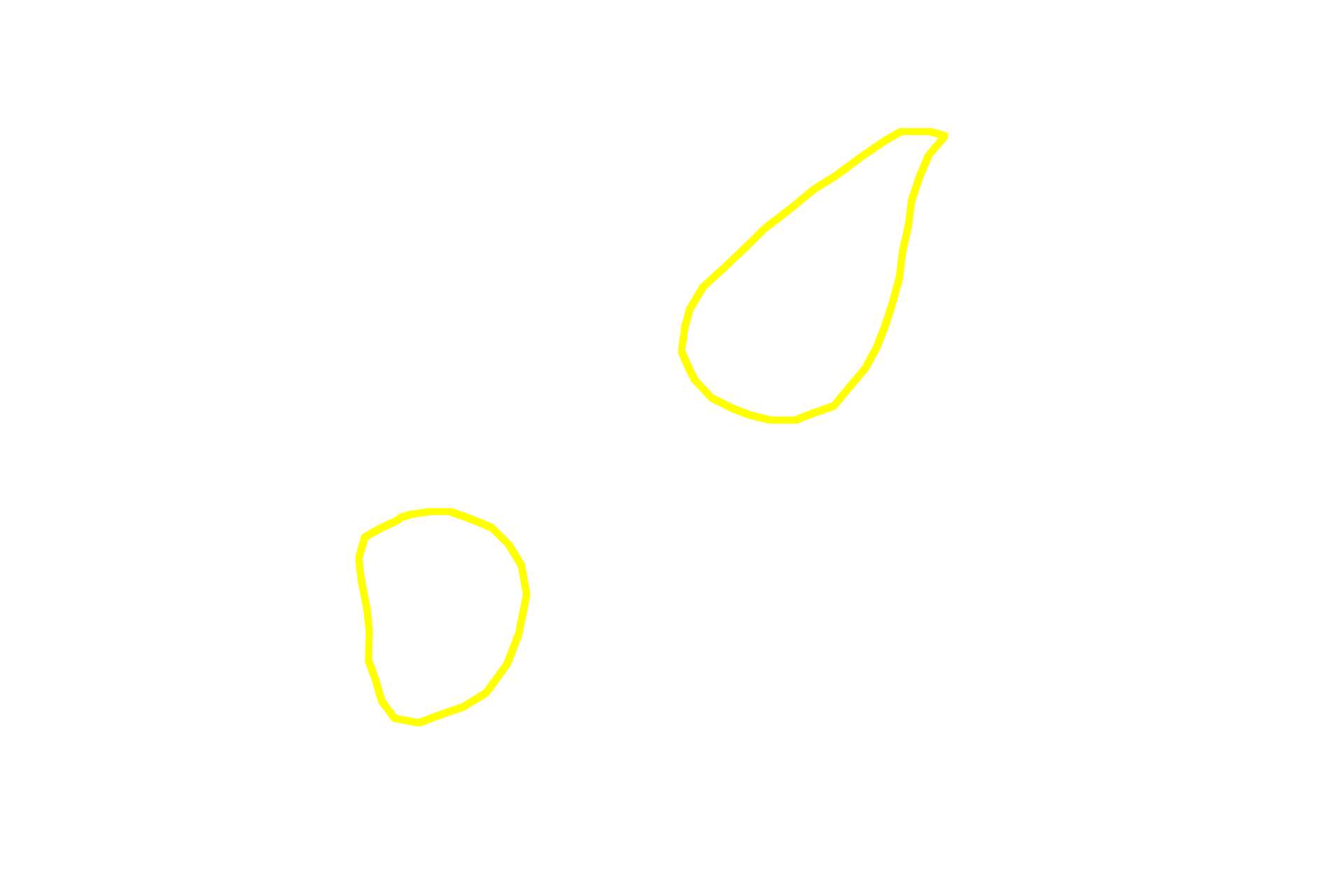 Prophase cells <p>Two cells in prophase are present among the interphase cells in this image from the basal layer of the esophageal epithelium.  Chromosomes are condensed in these cells and their nucleoli and nuclear envelopes are absent. 1000x</p>
