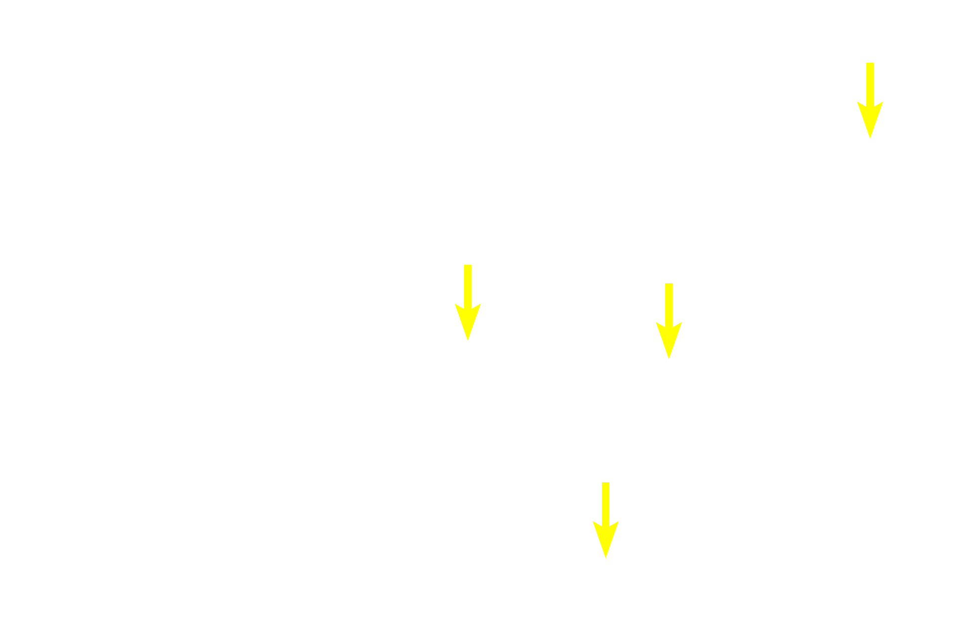 Interphase nuclei <p>Two cells in prophase are present among the interphase cells in this image from the basal layer of the esophageal epithelium.  Chromosomes are condensed in these cells and their nucleoli and nuclear envelopes are absent. 1000x</p>
